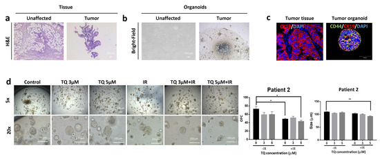 Thymoquinone Radiosensitizes Human Colorectal Cancer Cells in 2D and 3D ...