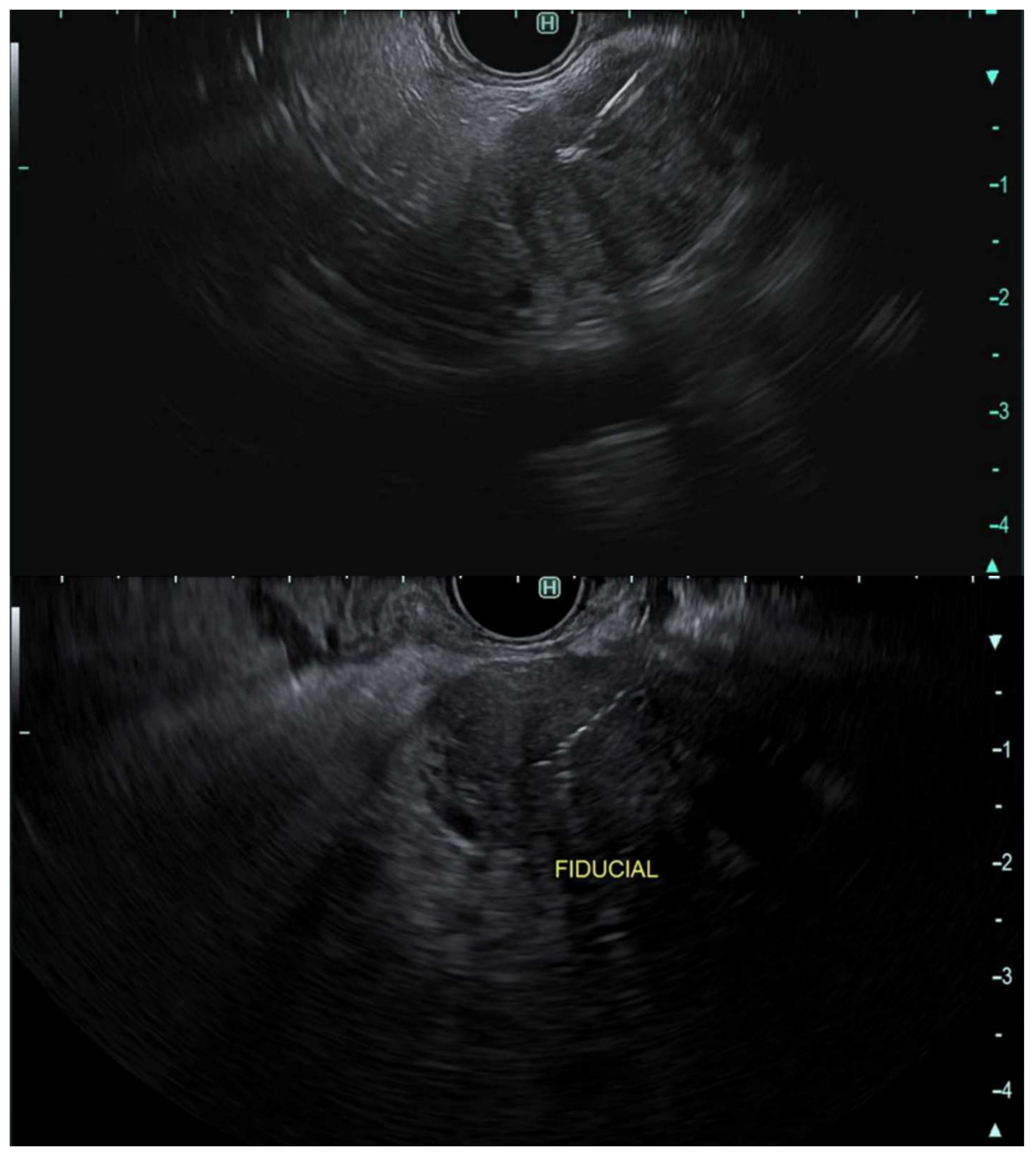 Cancers 14 01373 g005 Cancers 14 01373 g005