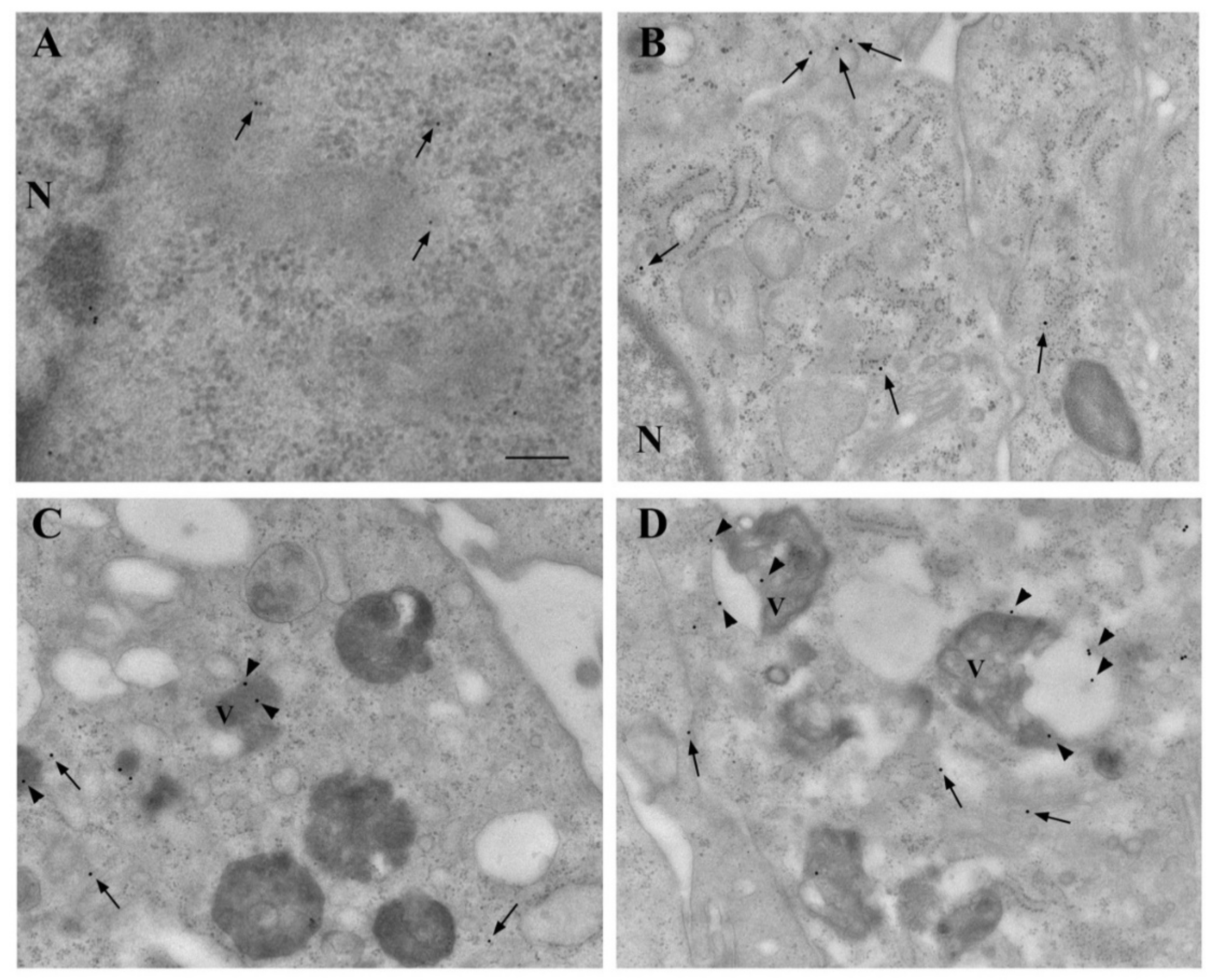 Cancers 14 01382 g012 Cancers 14 01382 g012