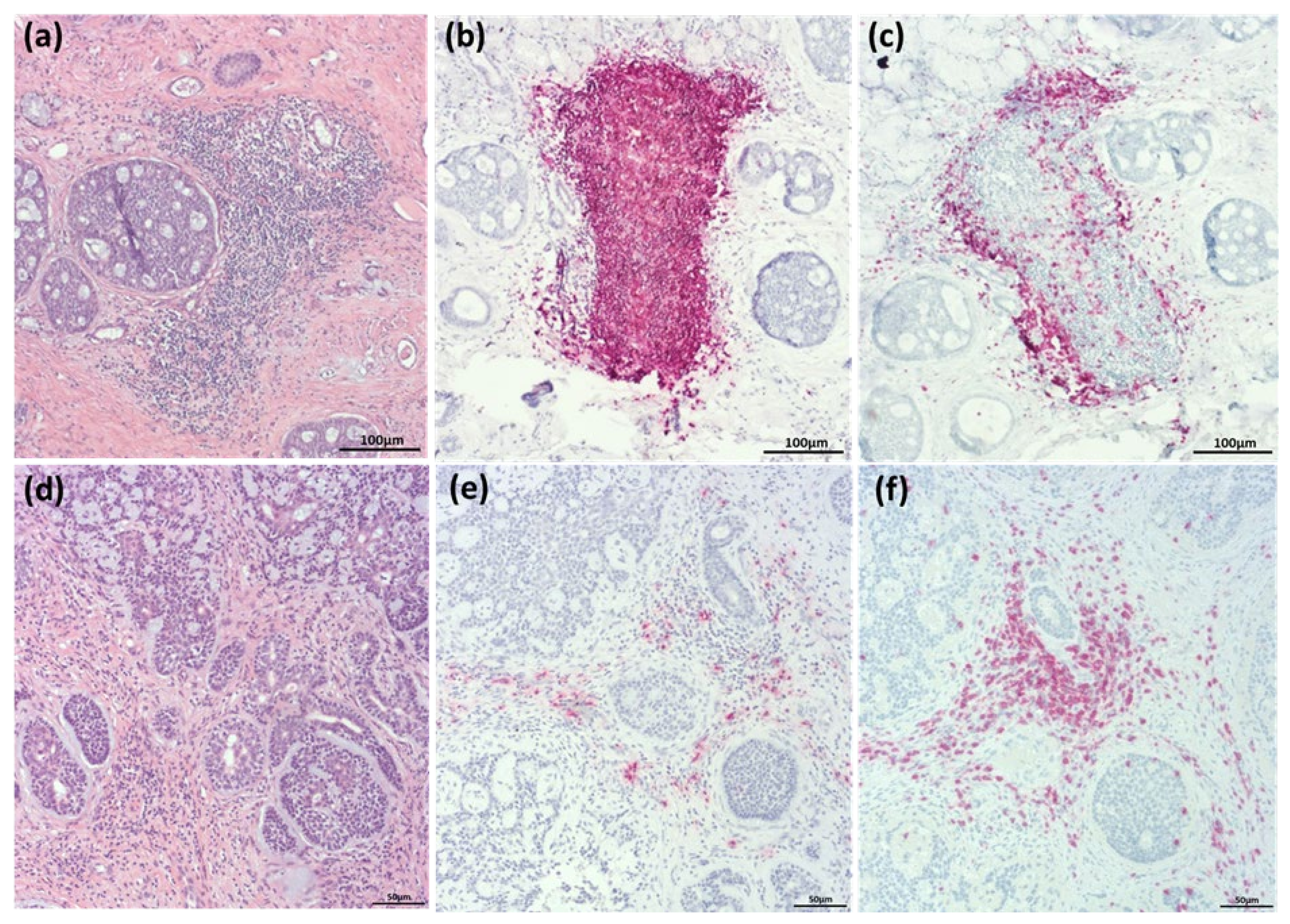 Cancers 14 01383 g001 550