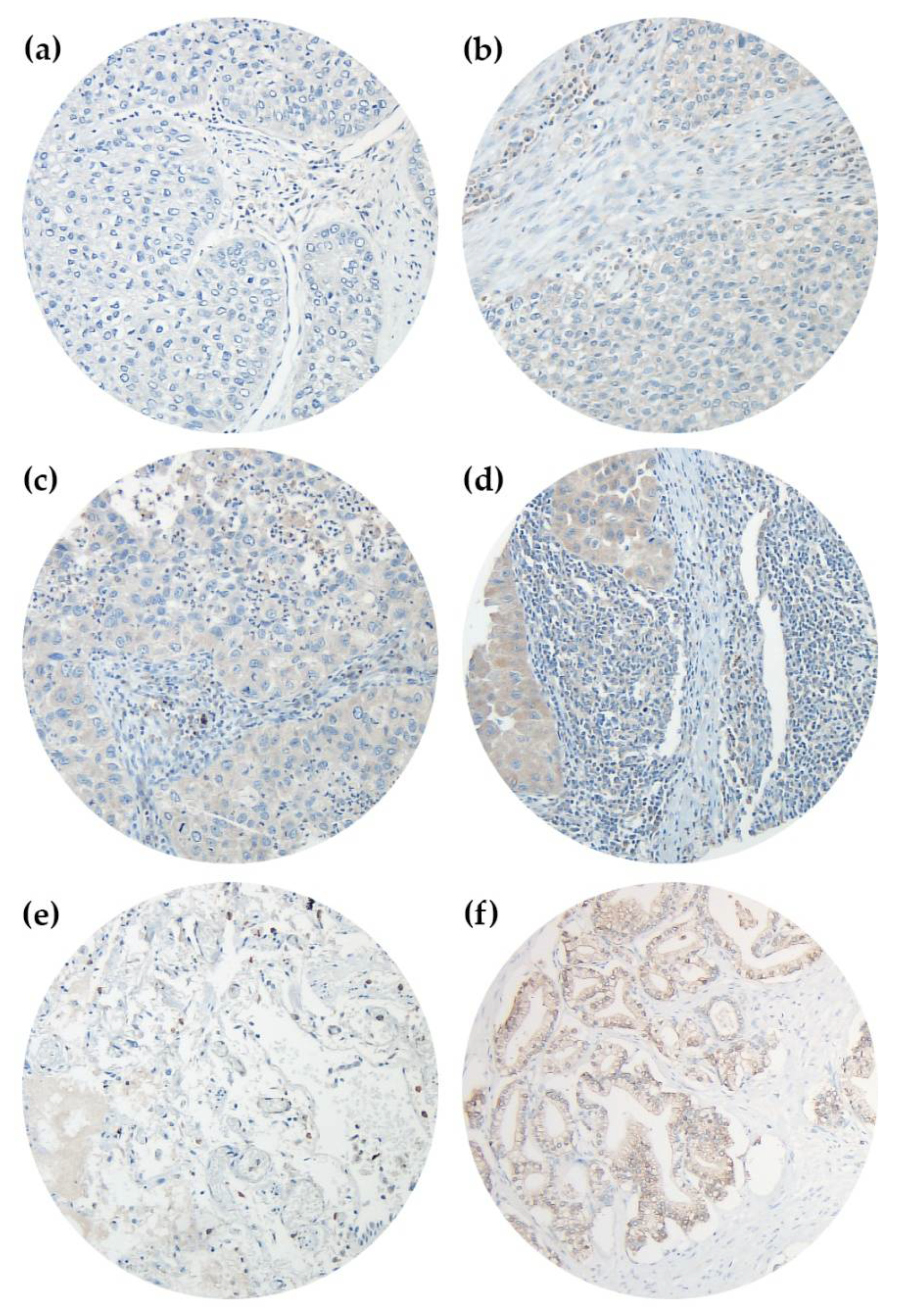 Cancers 14 01395 g001