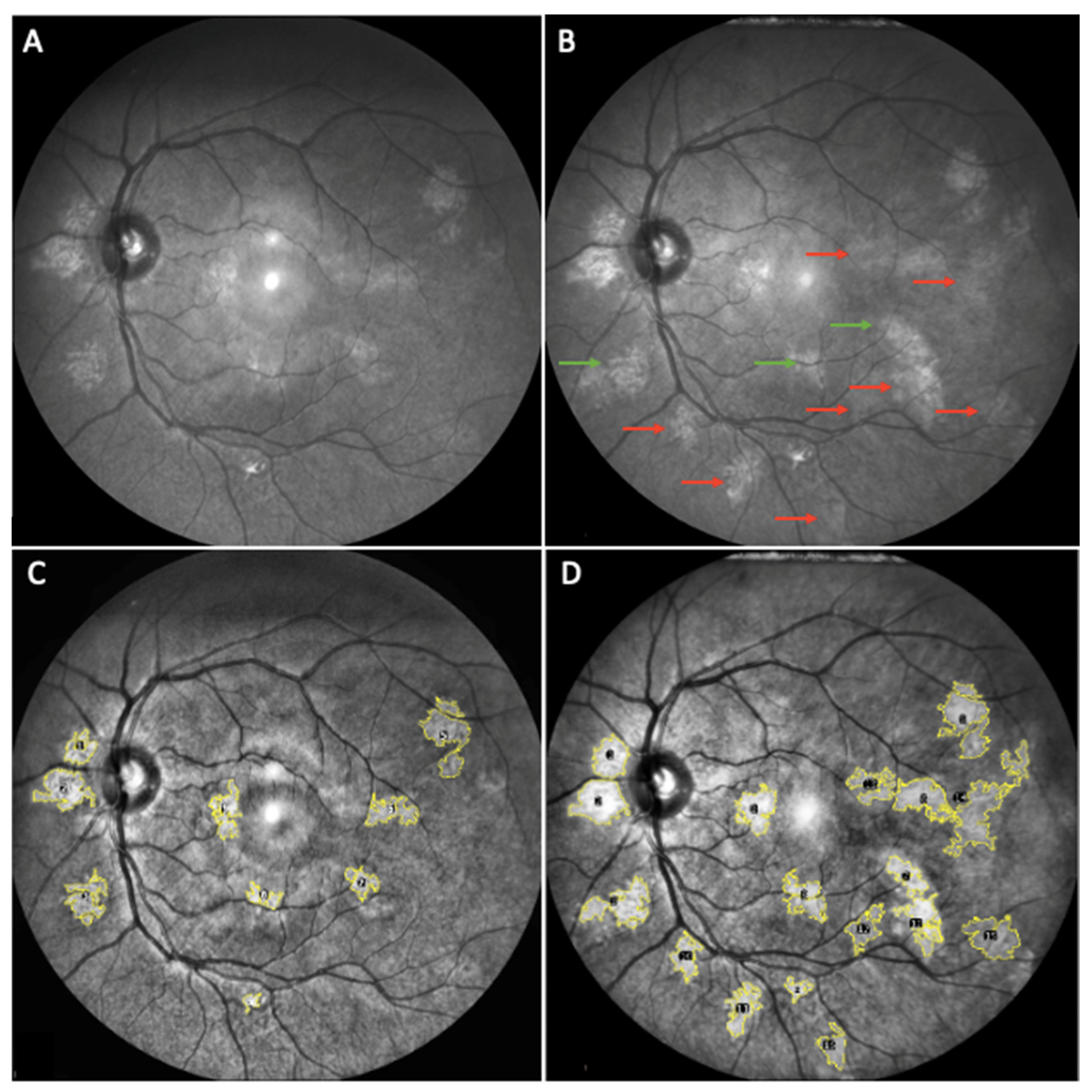 Cancers 14 01423 g002 550