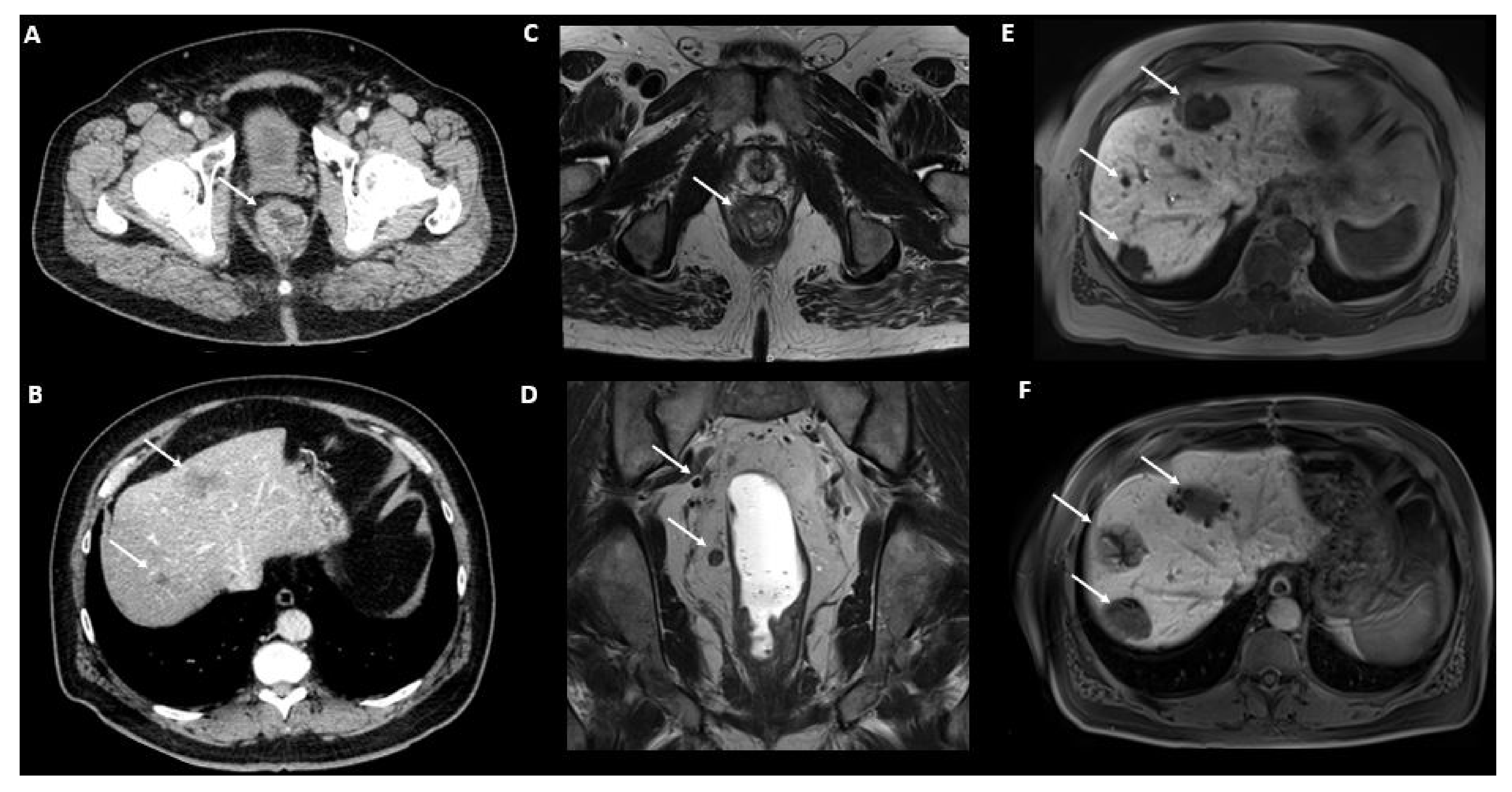 Cancers 14 01427 g001