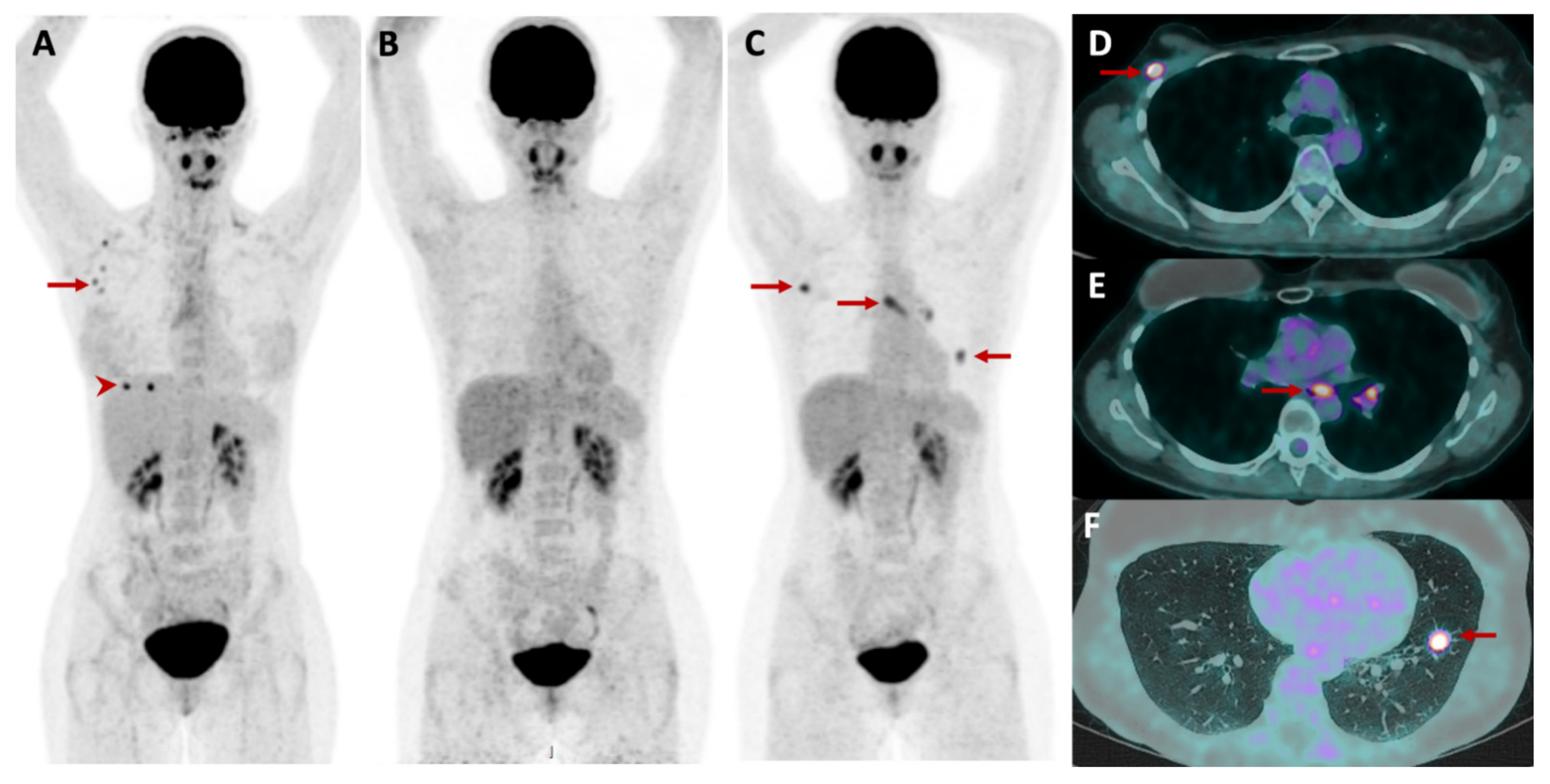 Cancers 14 01427 g002