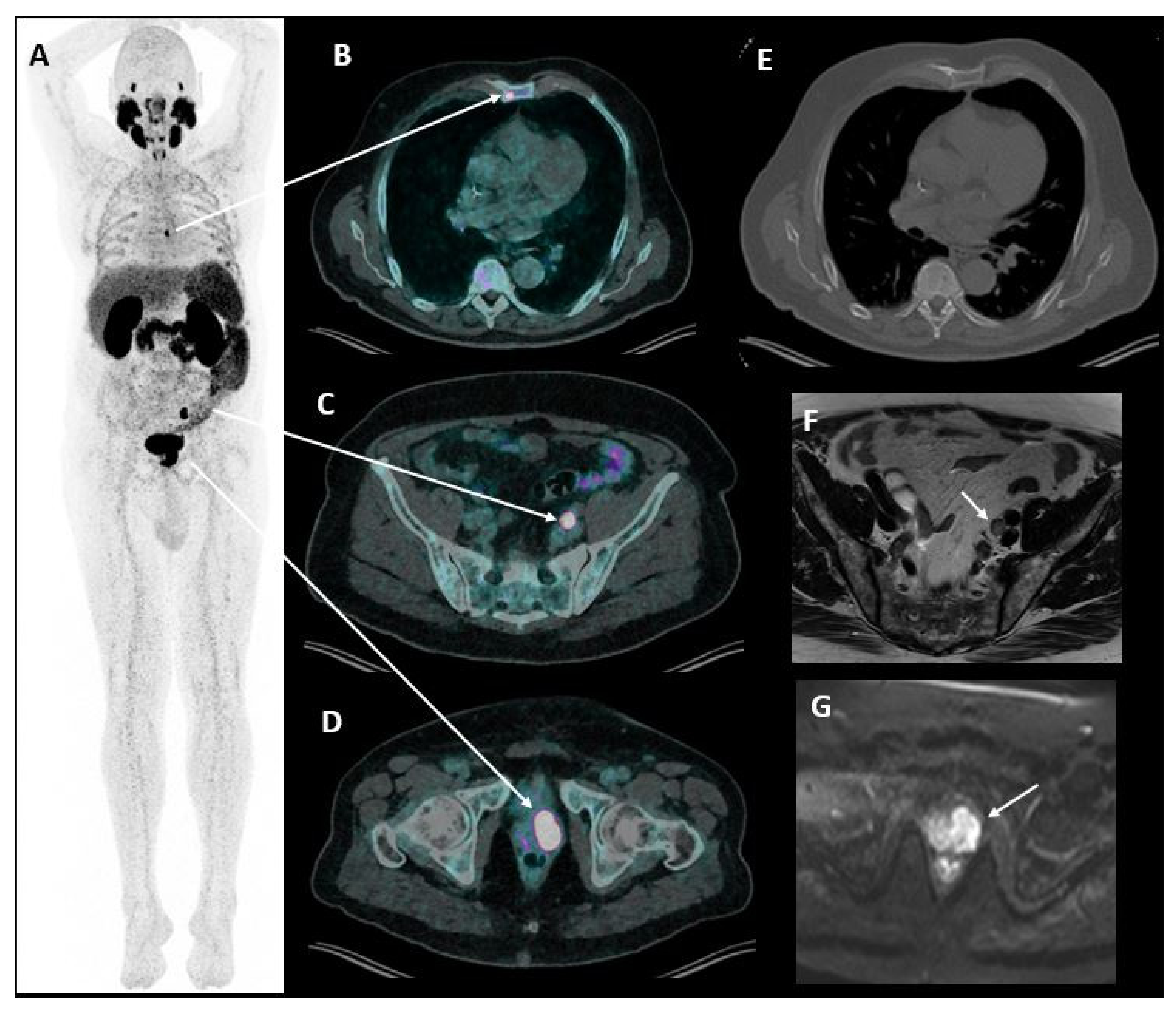 Cancers 14 01427 g003