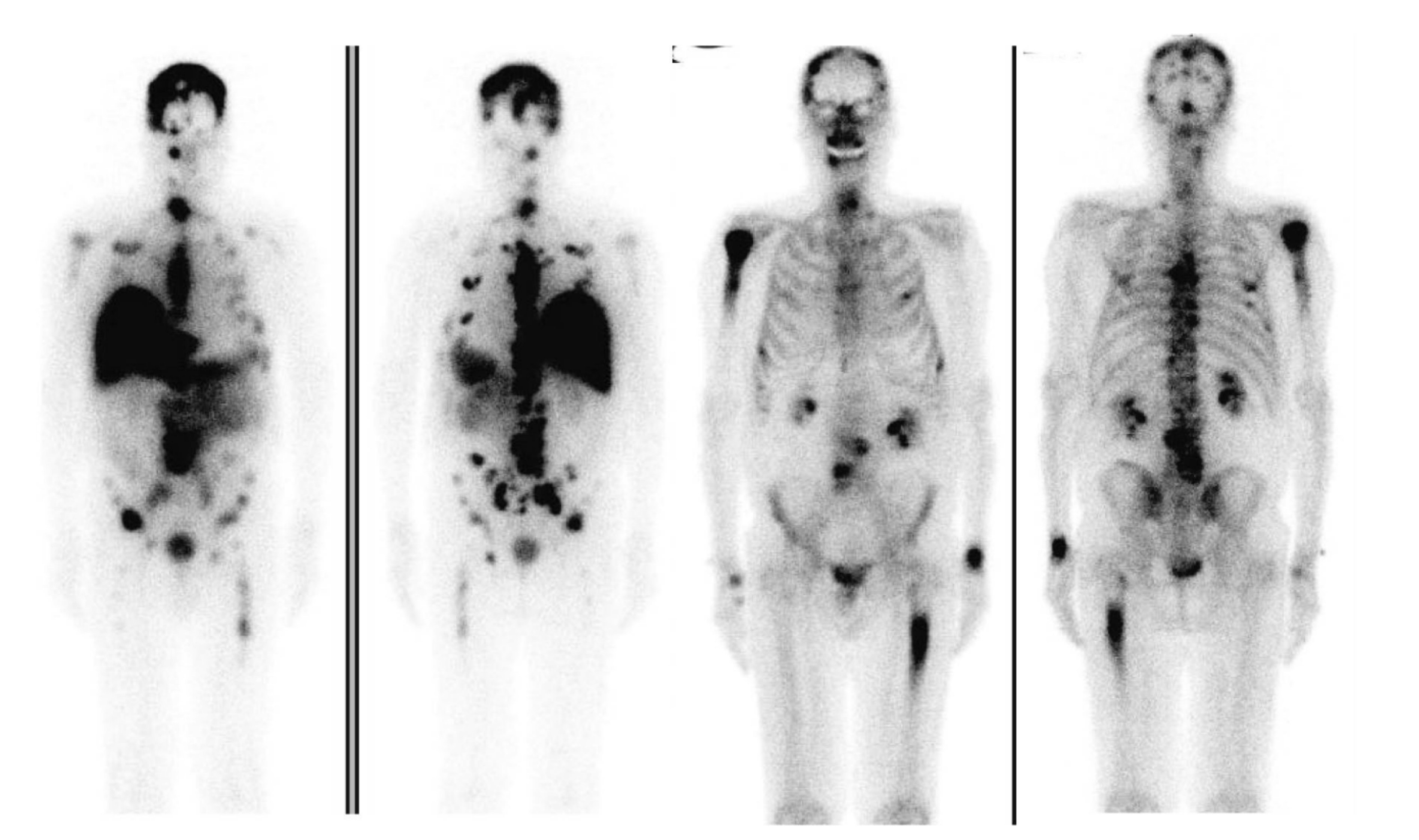 Cancers 14 01454 g003 Cancers 14 01454 g003