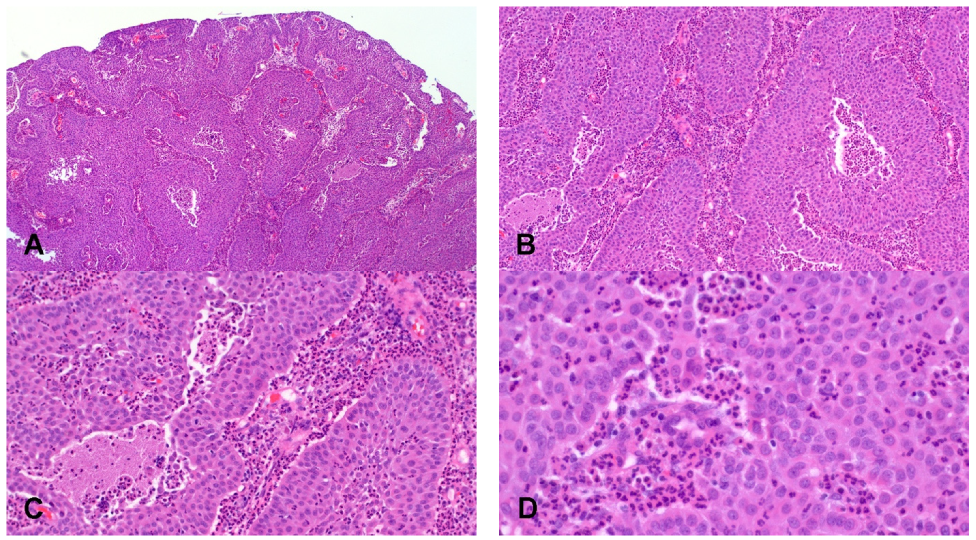 Cancers 14 01463 g002