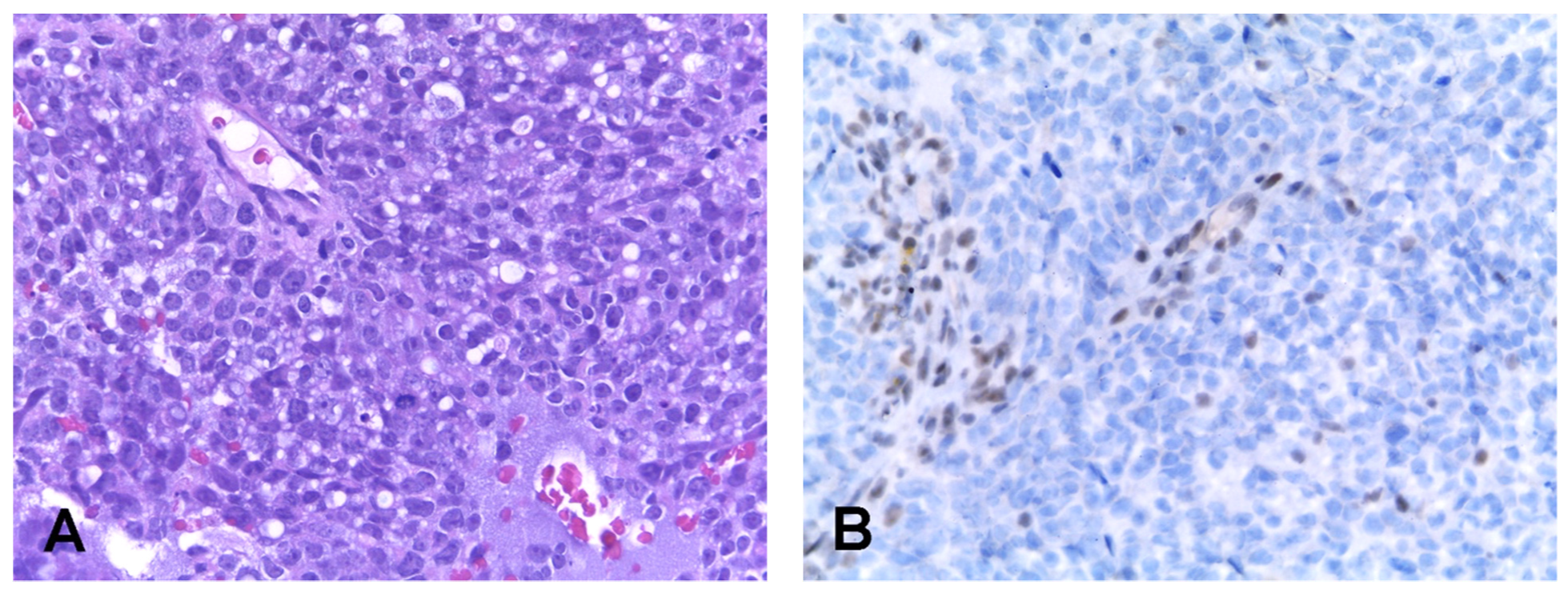 Cancers 14 01463 g003