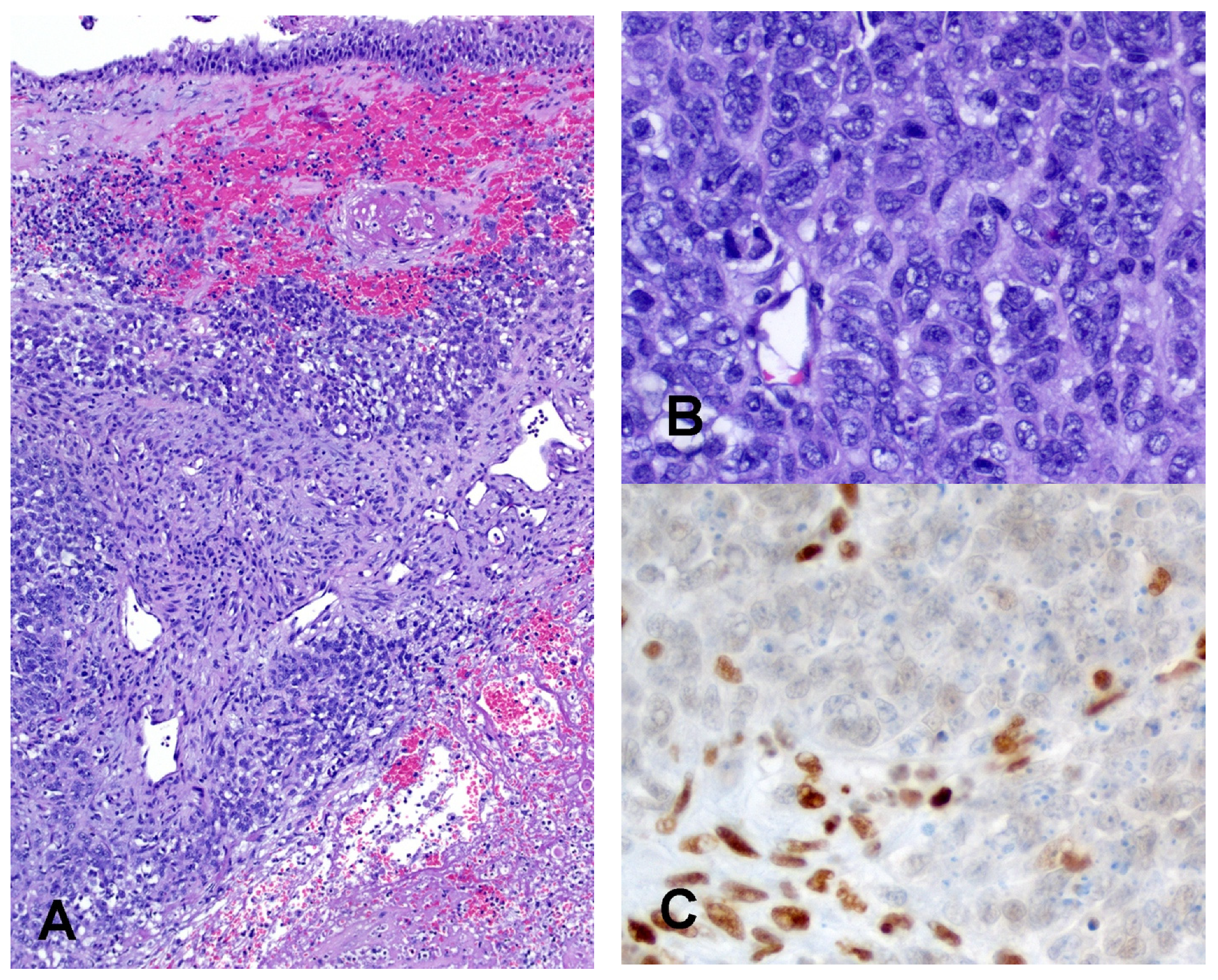 Cancers 14 01463 g004