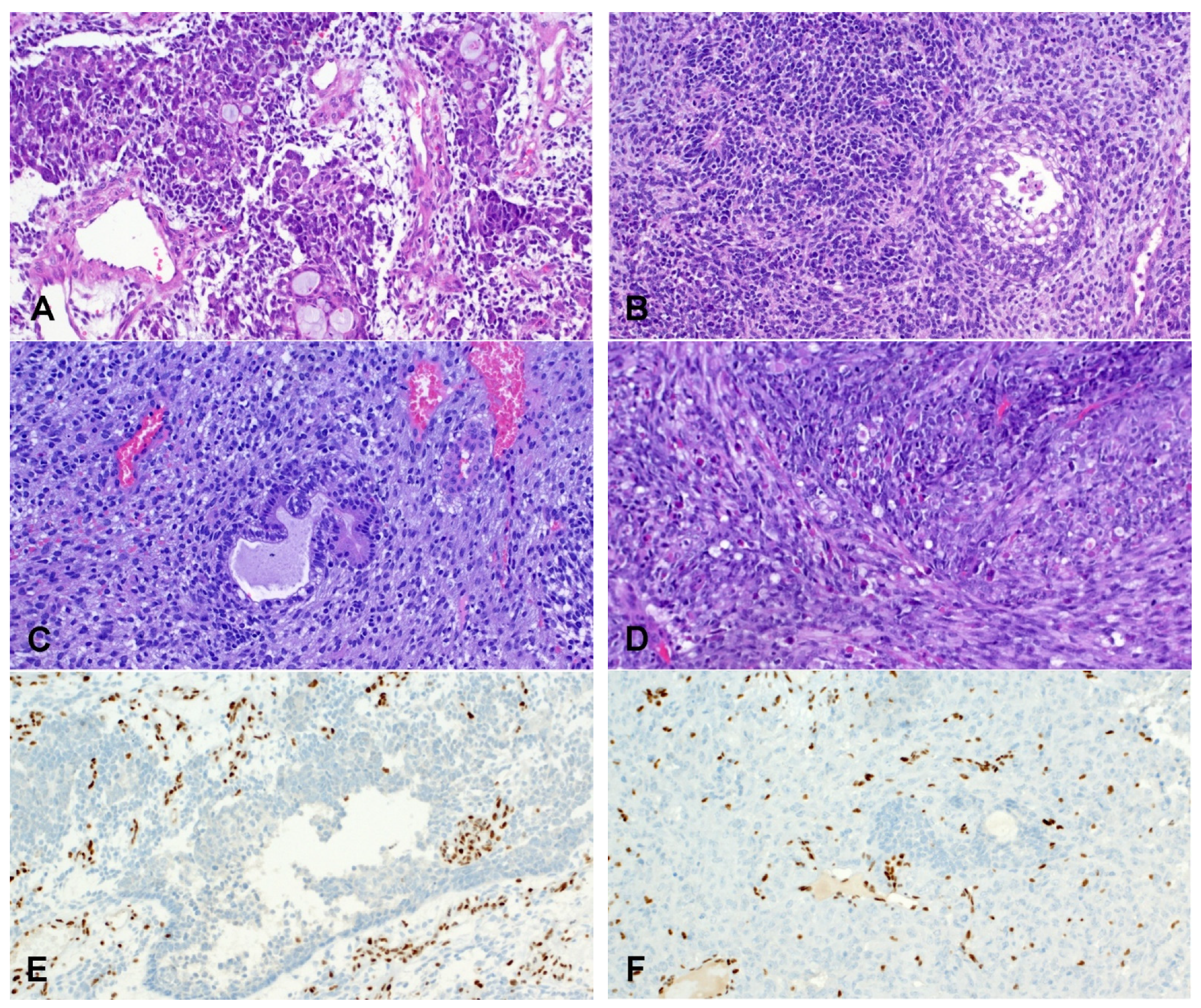 Cancers 14 01463 g005