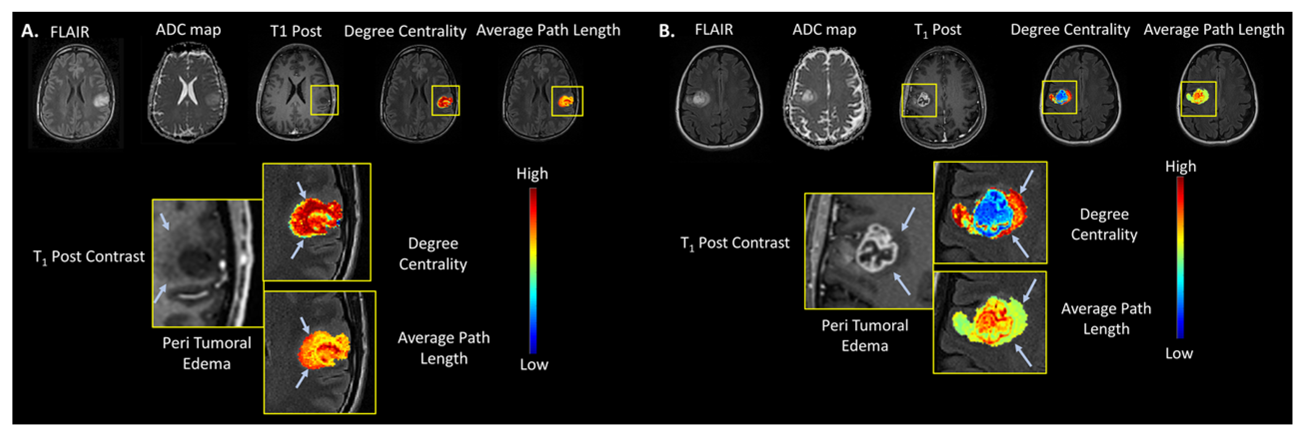 Cancers 14 01481 g004 550