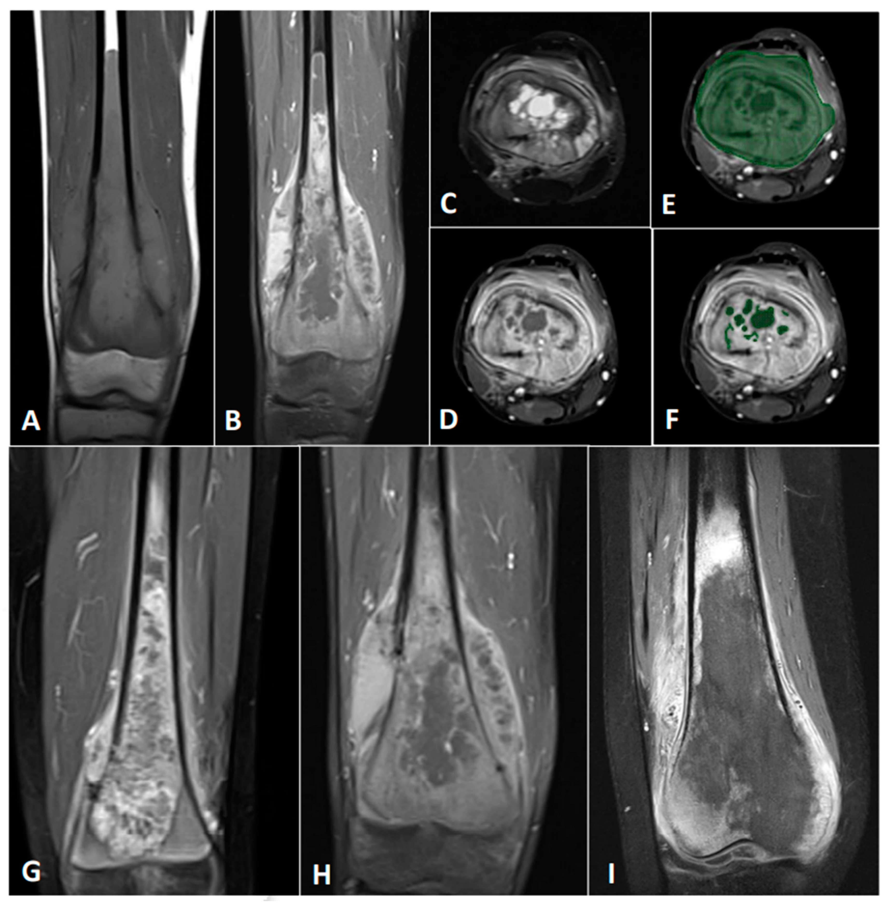 Cancers 14 01482 g002