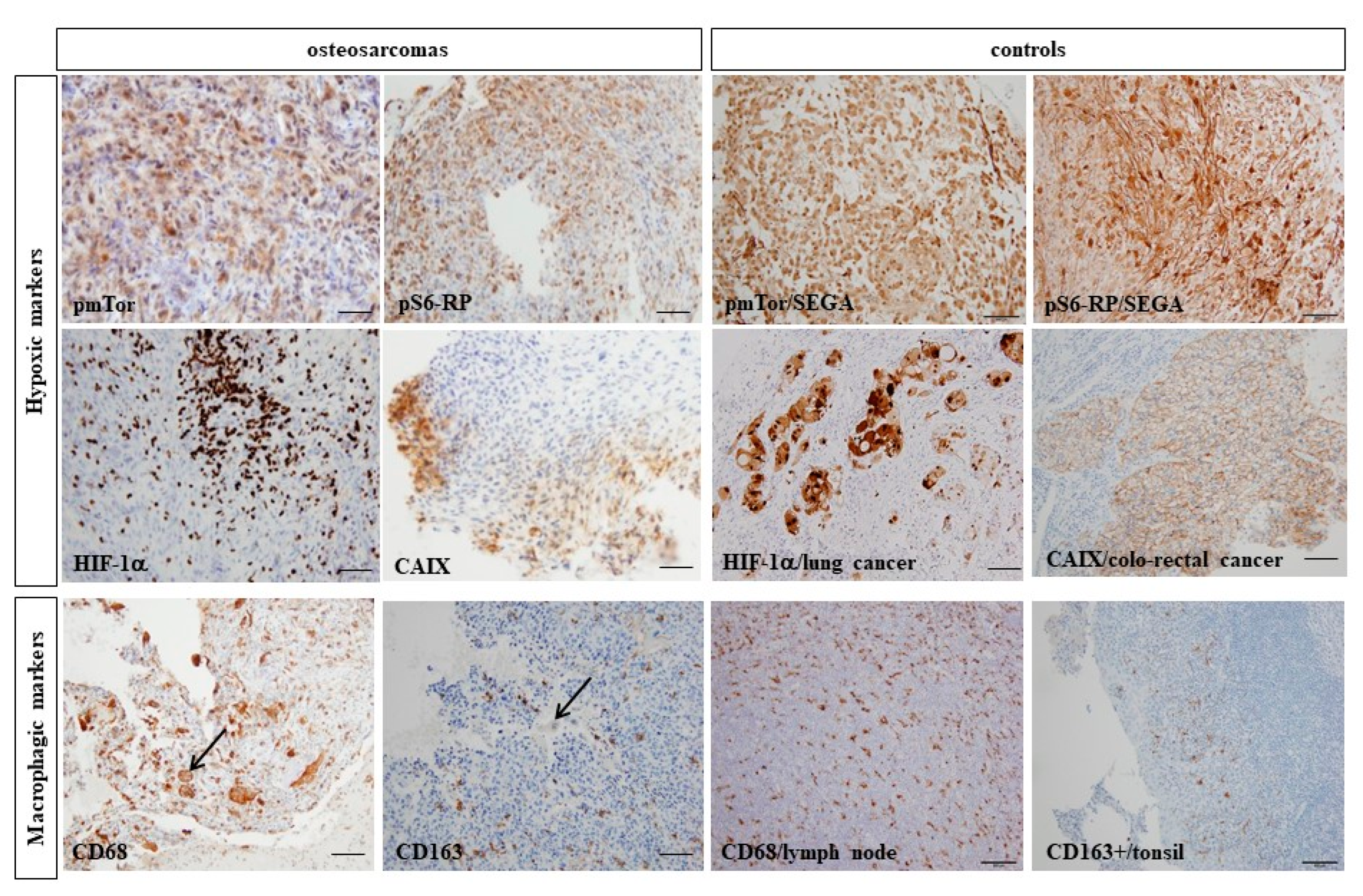 Cancers 14 01482 g005