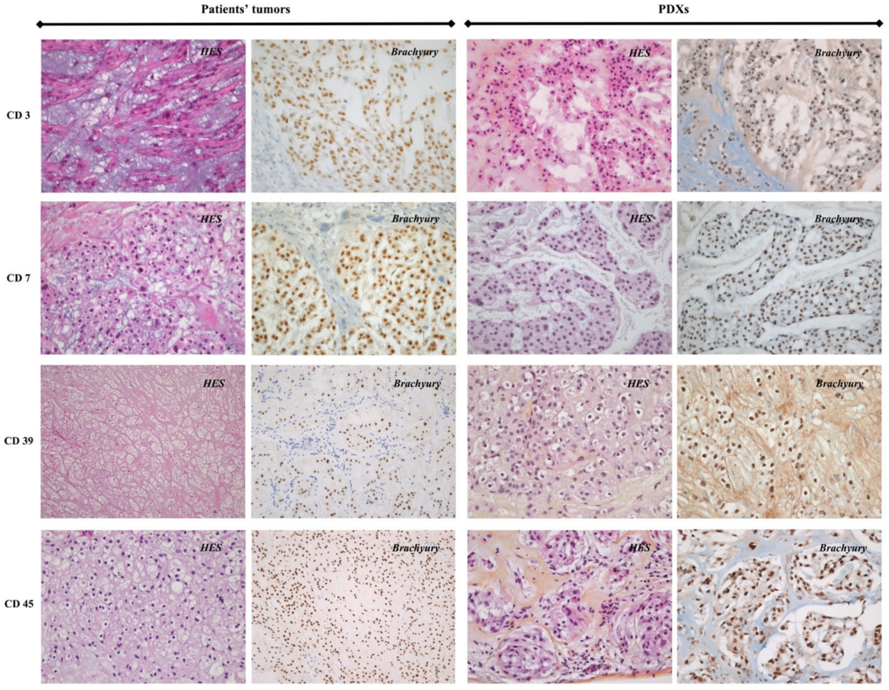 Cancers 14 01486 g002