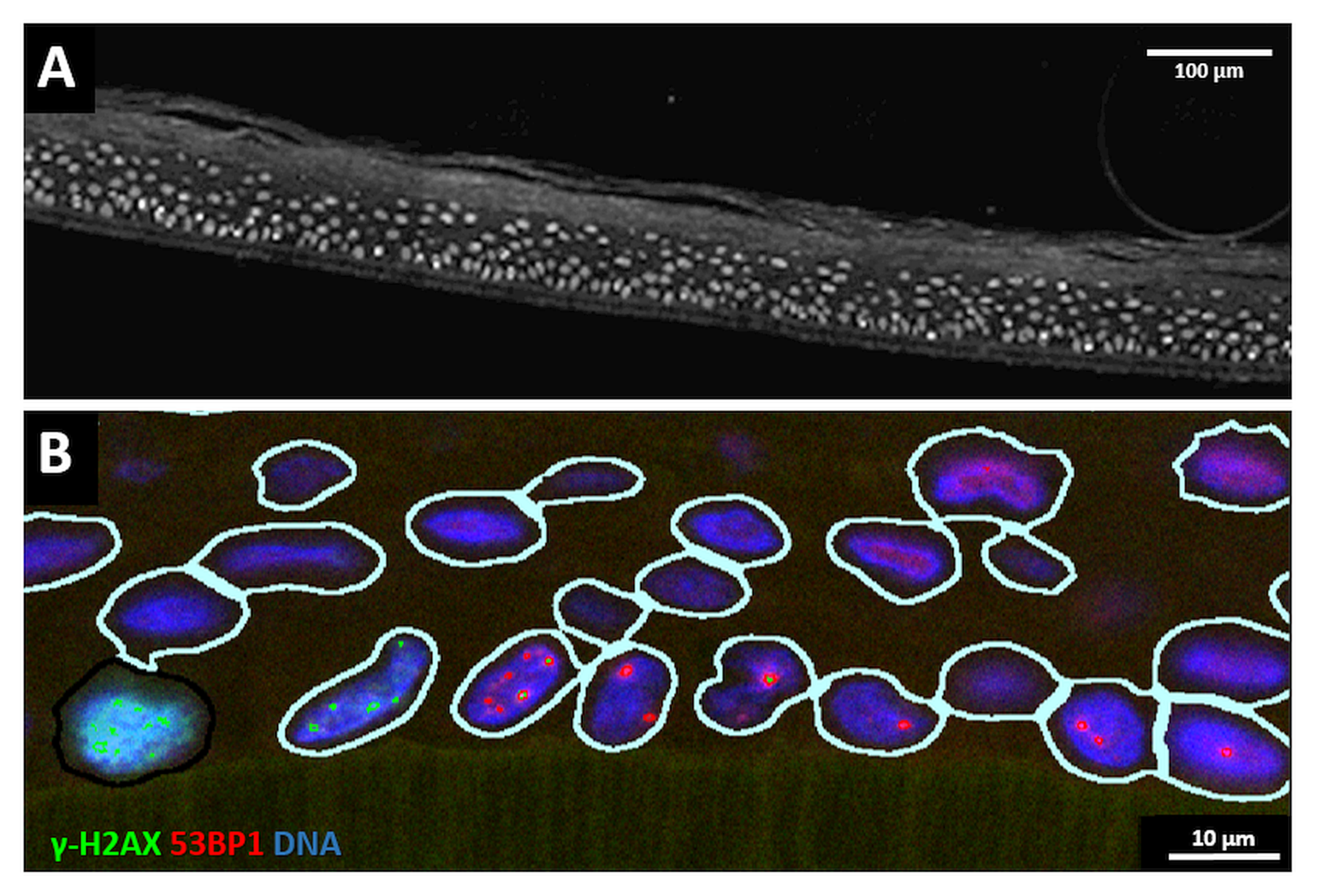 Cancers 14 01545 g003
