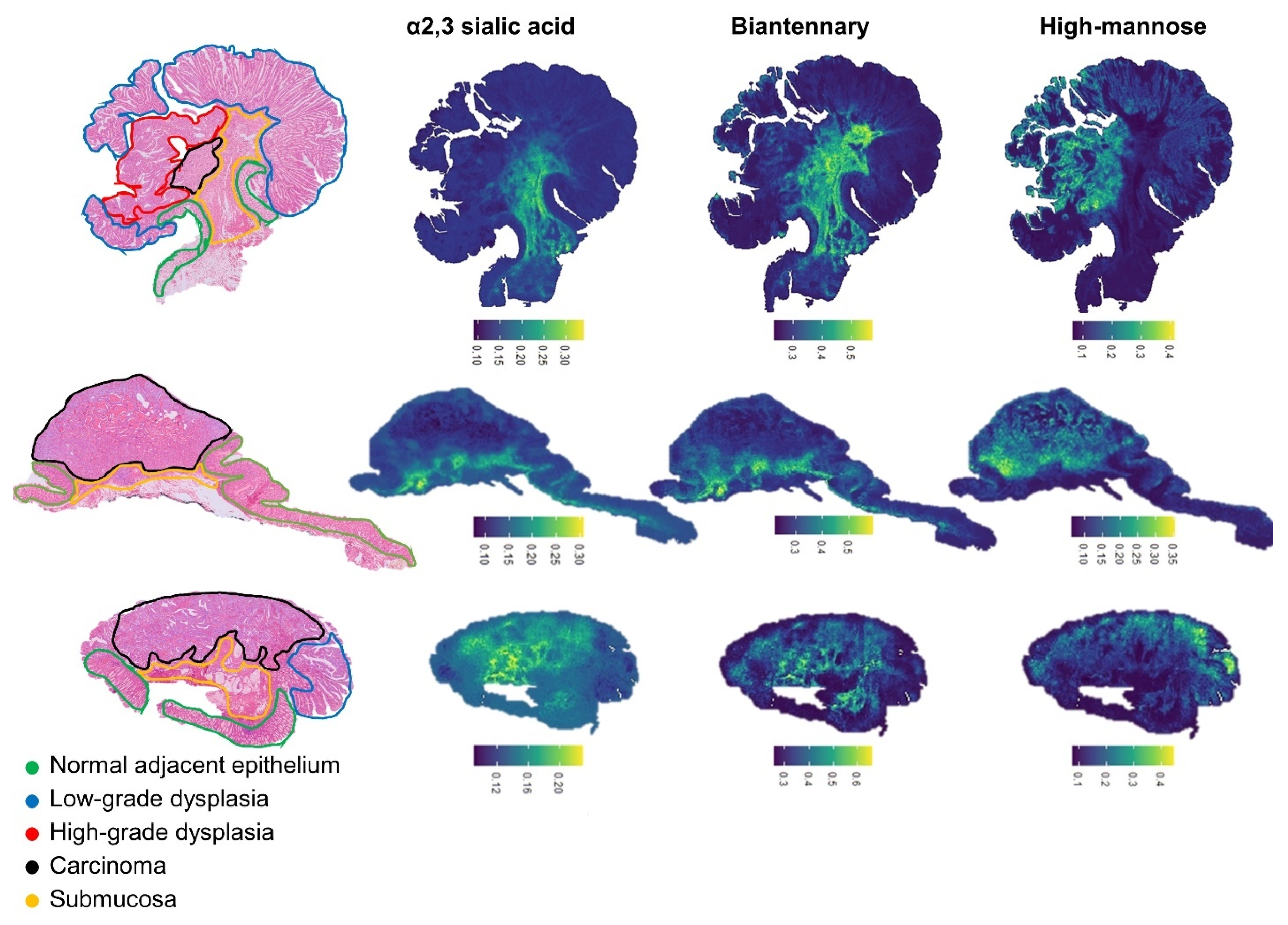Cancers 14 01552 g003 550