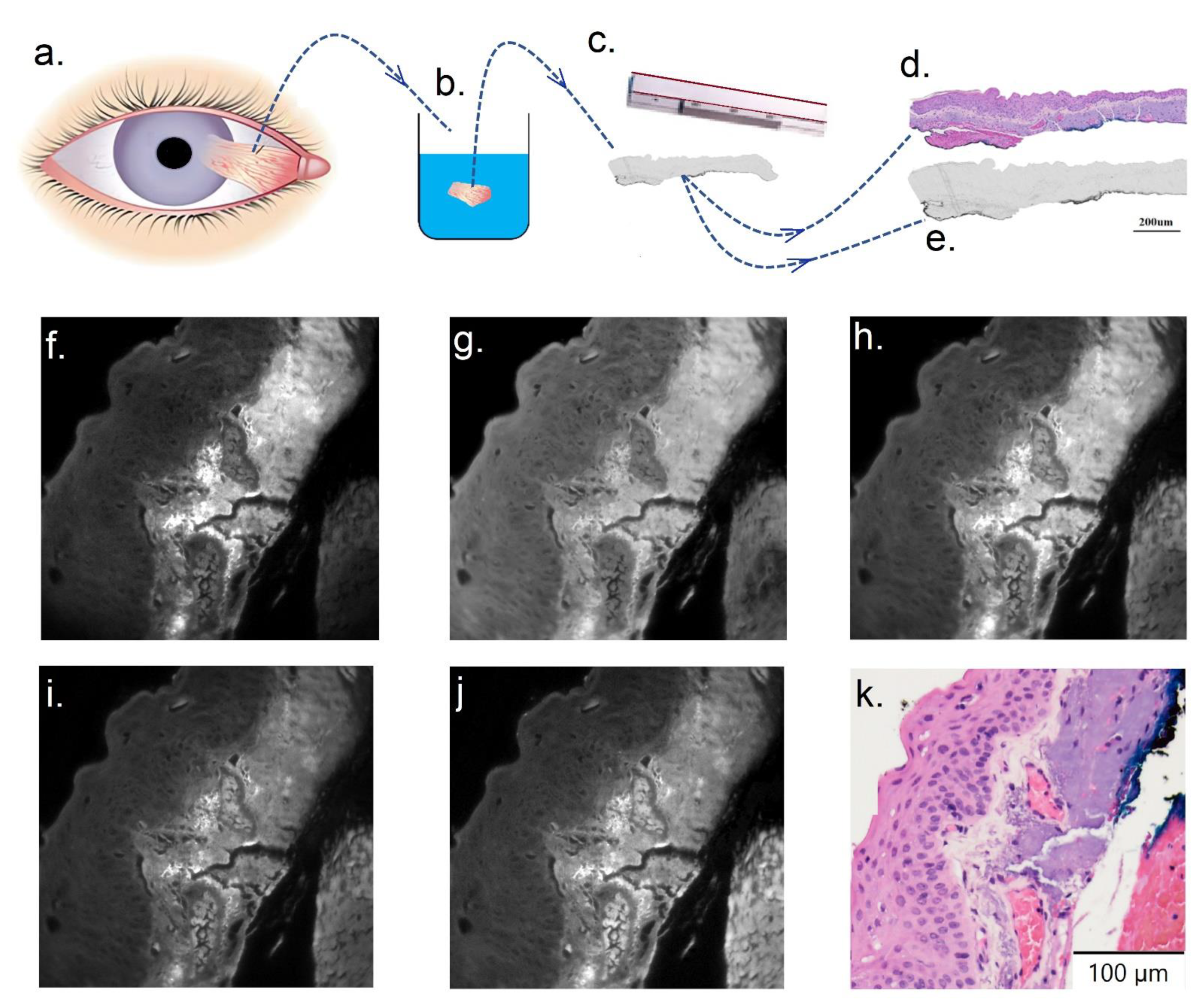 Cancers 14 01591 g002