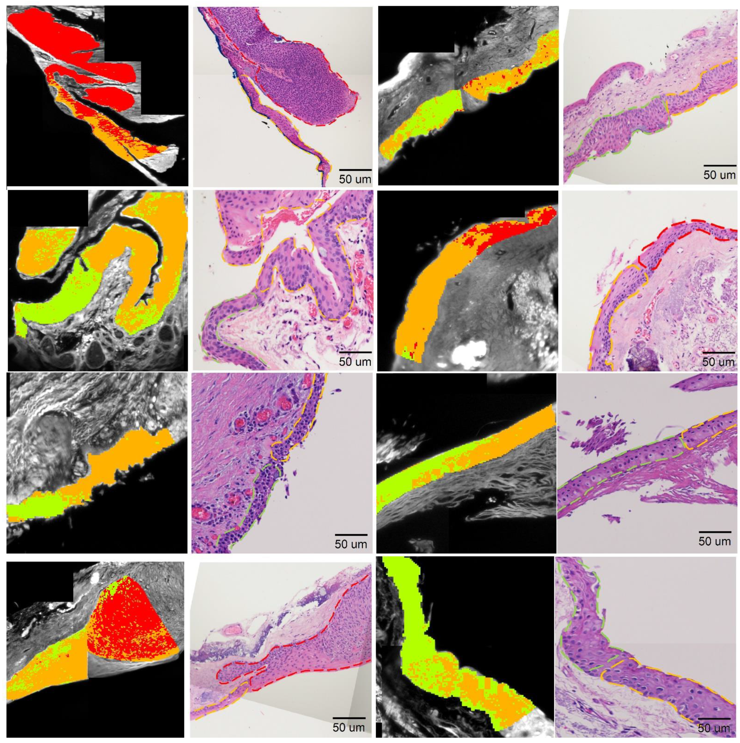 Cancers 14 01591 g006