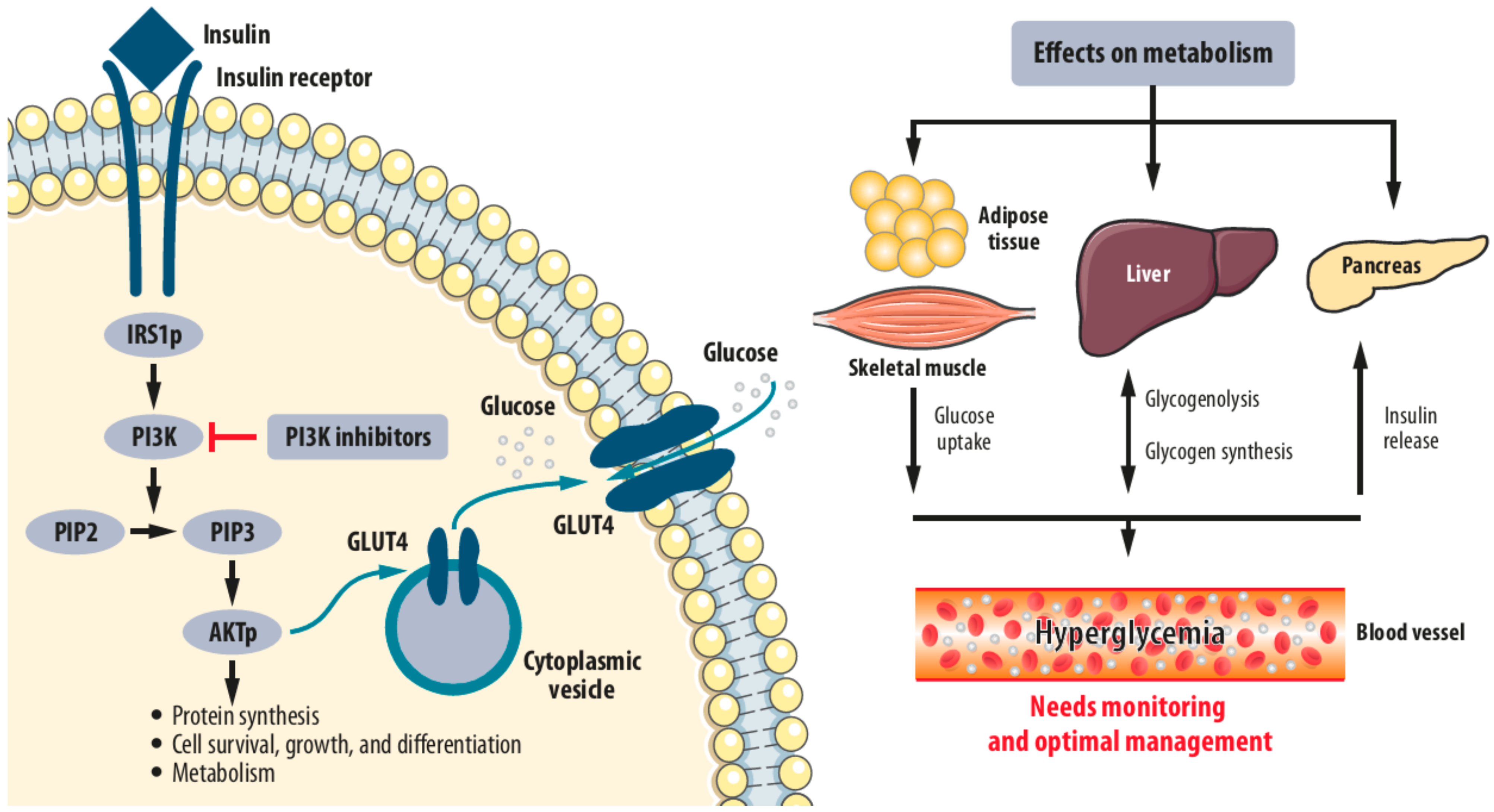 Hiperglucemia y cetosis ejercicio fisico en diabetes tipo 2 pdf