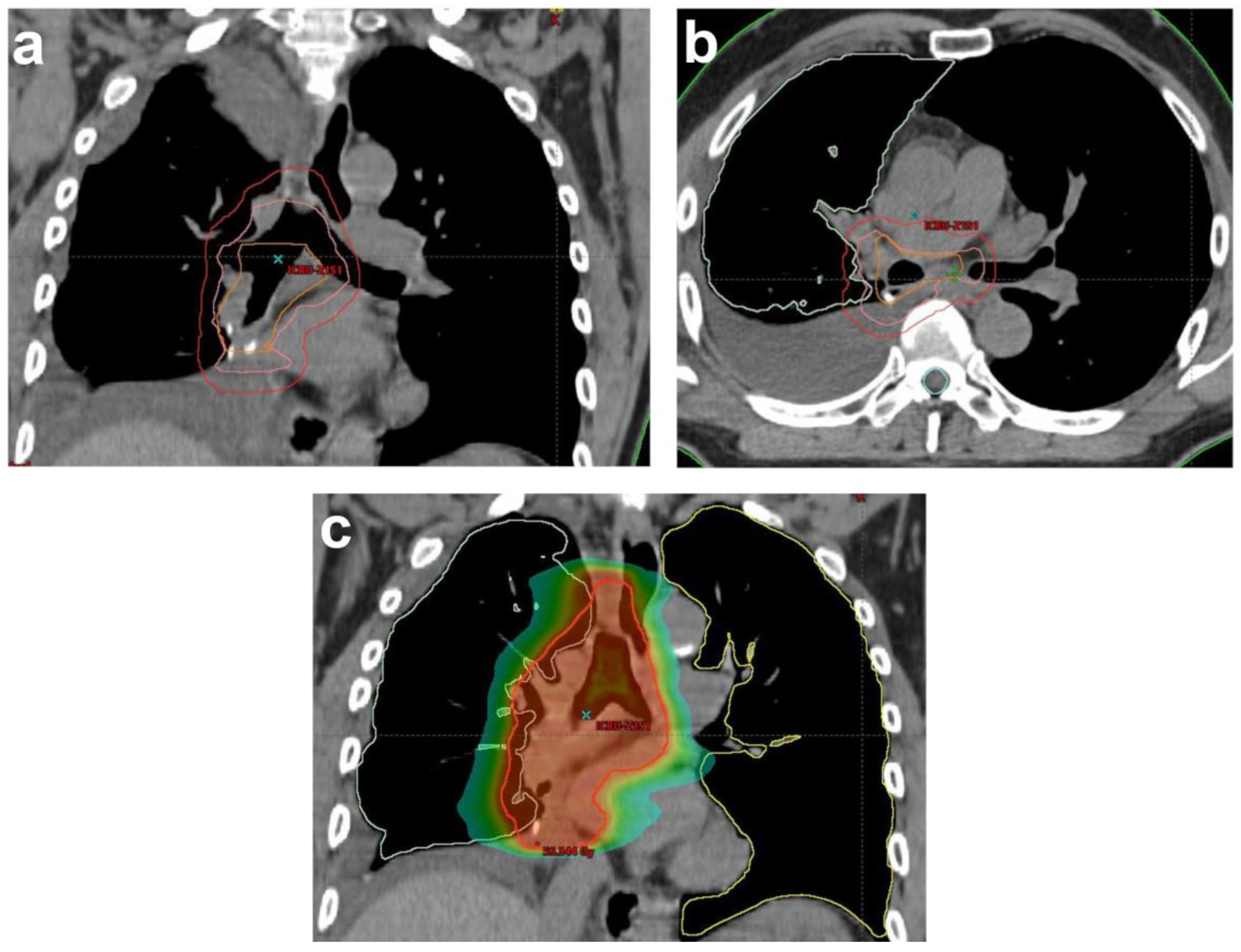 Cancers 14 01617 g001