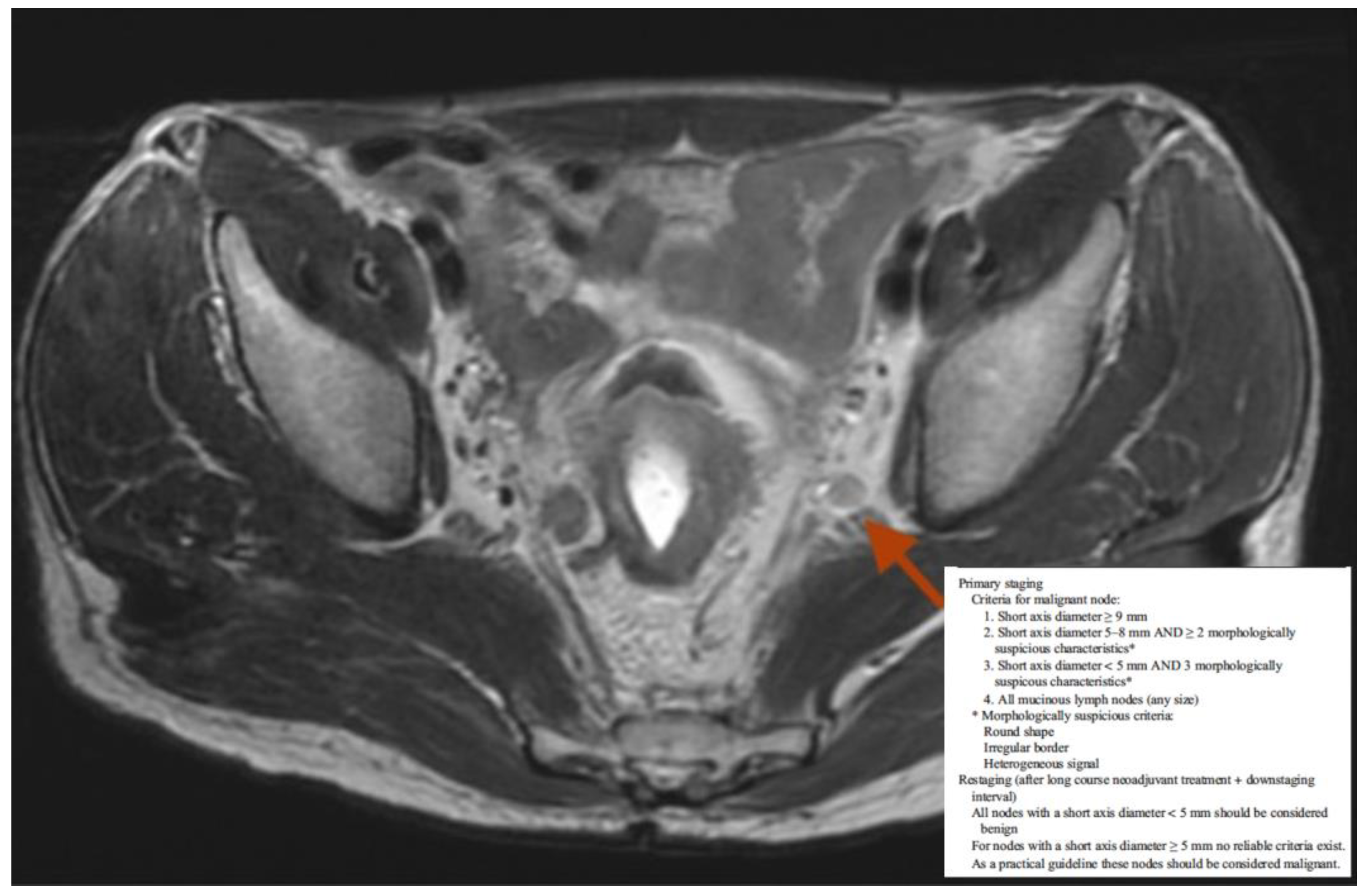 Cancers 14 01643 g001