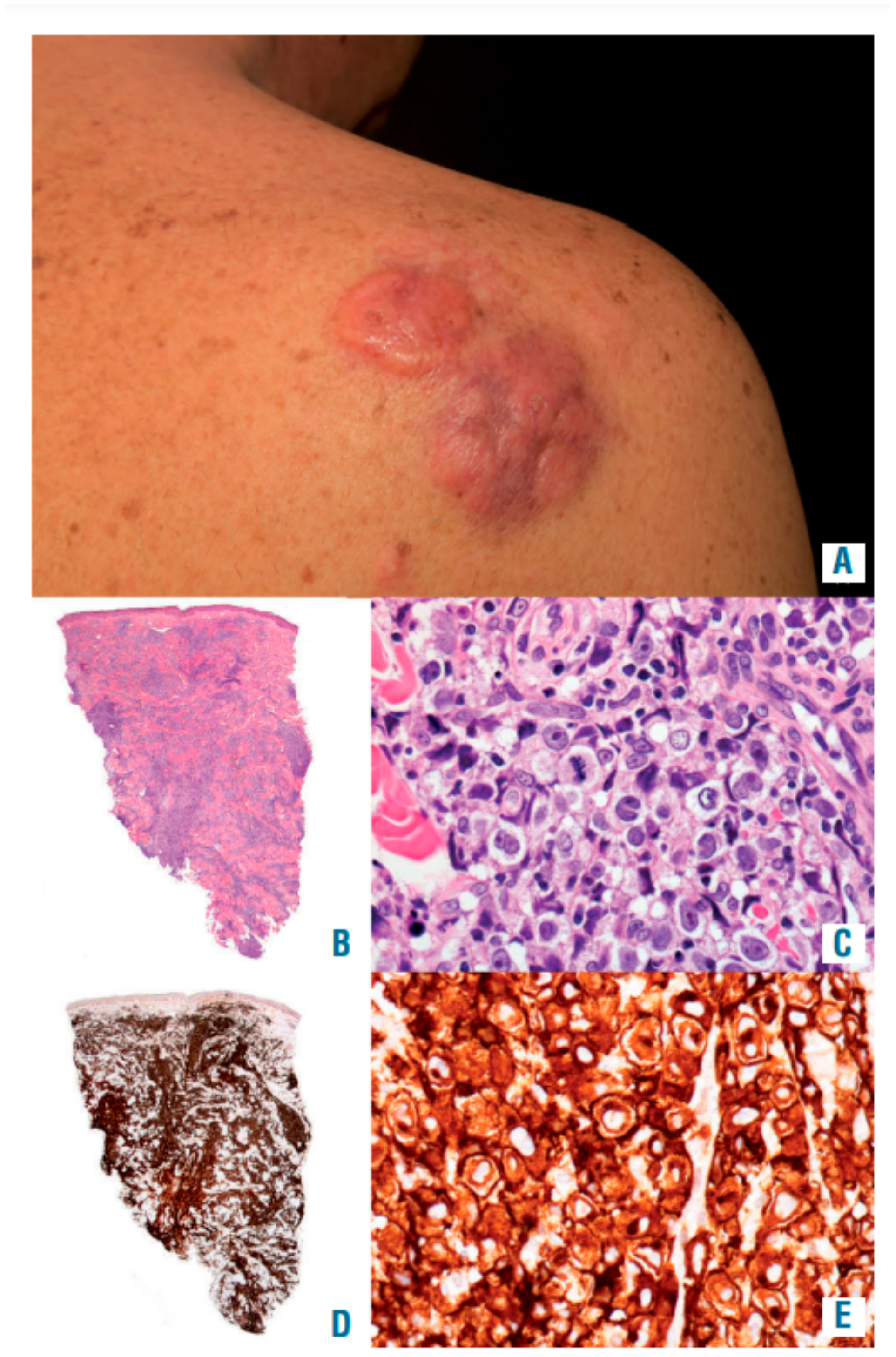 Cancers 14 01650 g006 Cancers 14 01650 g006