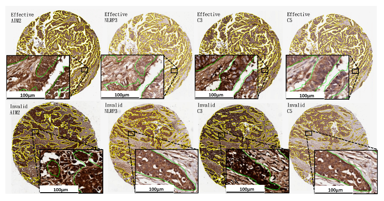 Cancers 14 01651 g001