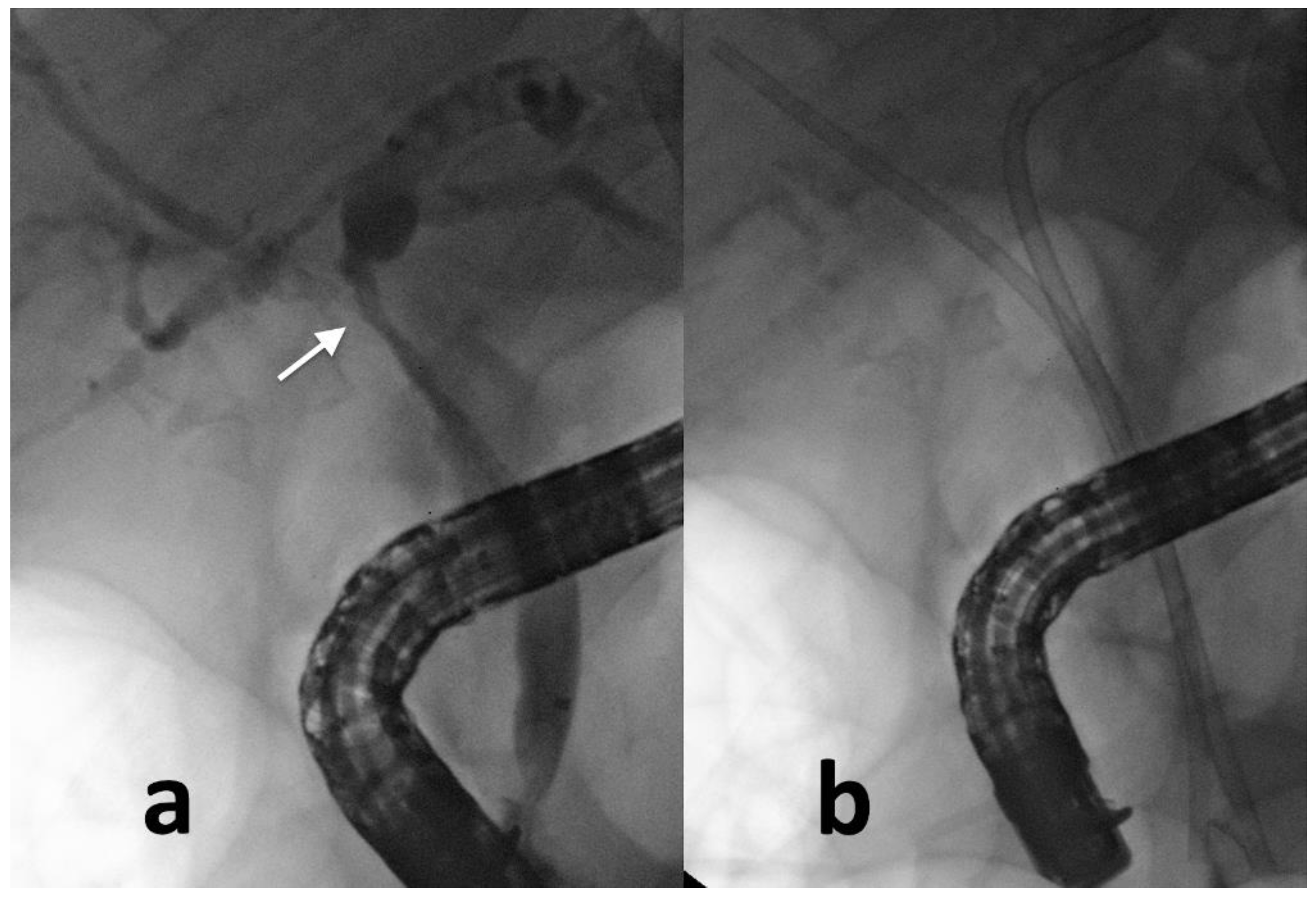 Cancers 14 01686 g001 Cancers 14 01686 g001