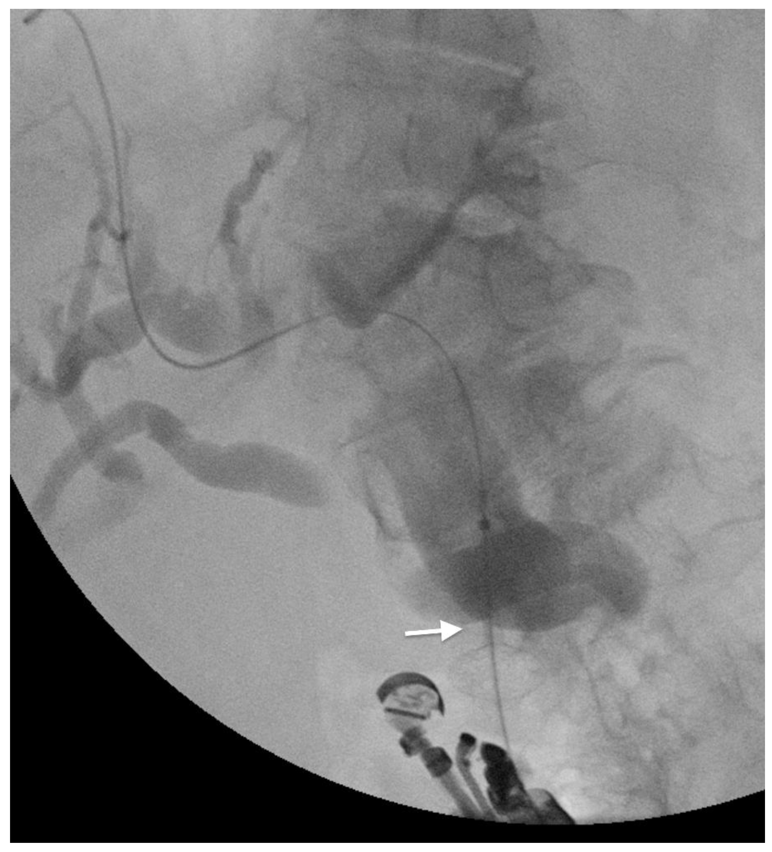 Cancers 14 01686 g003 Cancers 14 01686 g003