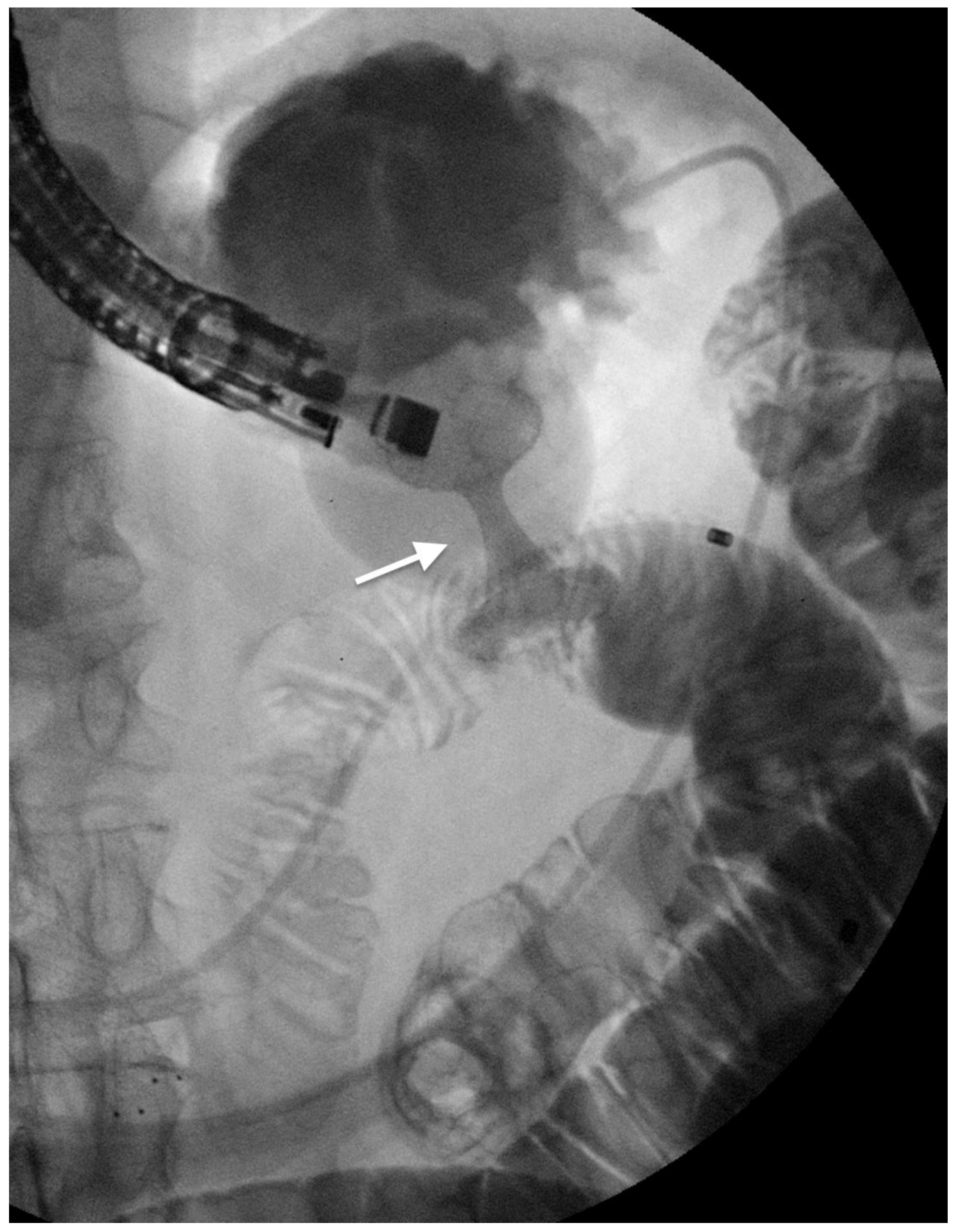 Cancers 14 01686 g005 Cancers 14 01686 g005