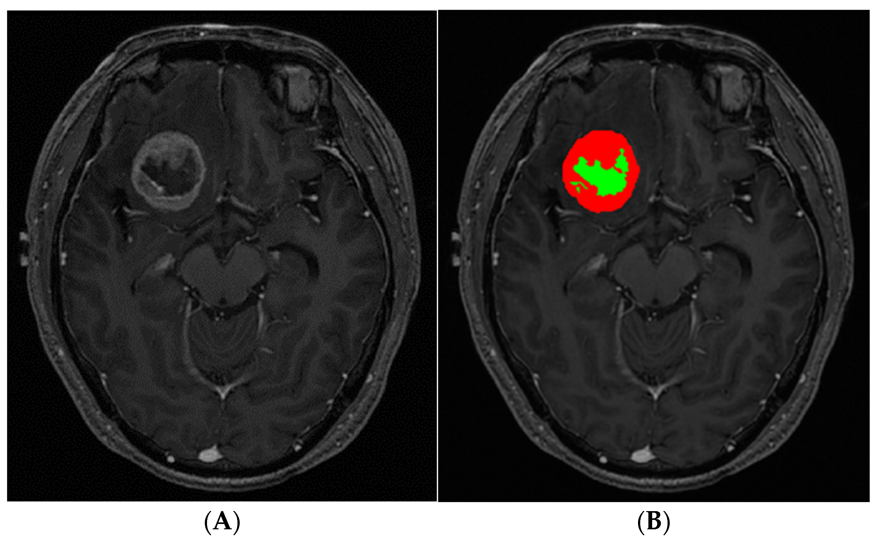 Cancers 14 01694 g001 Cancers 14 01694 g001