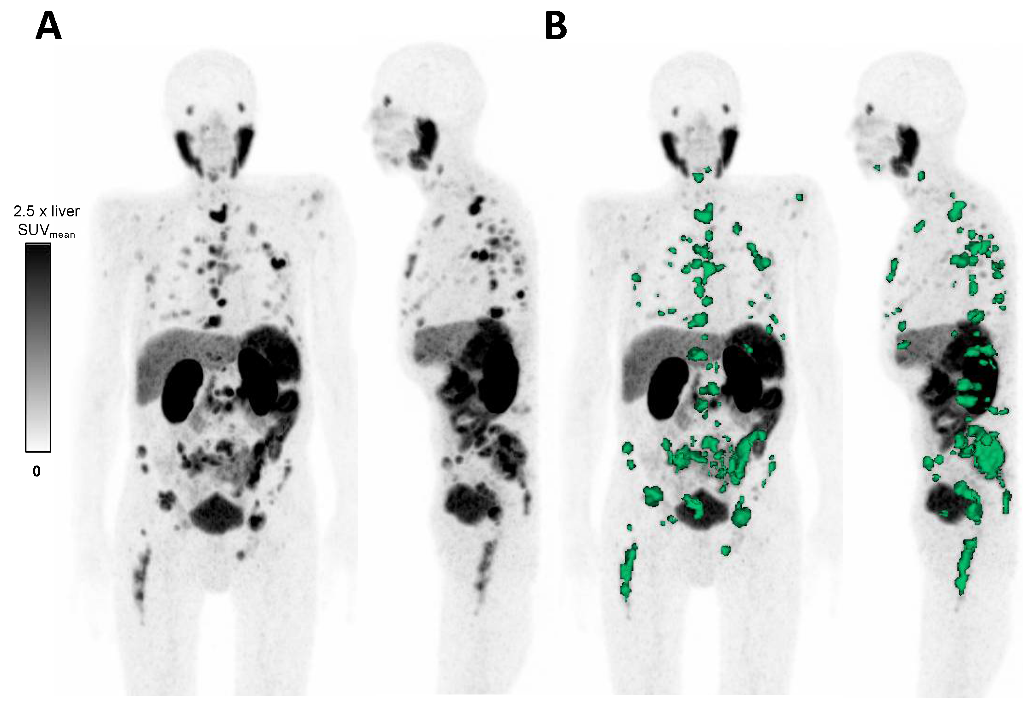 Cancers 14 01696 g001 550