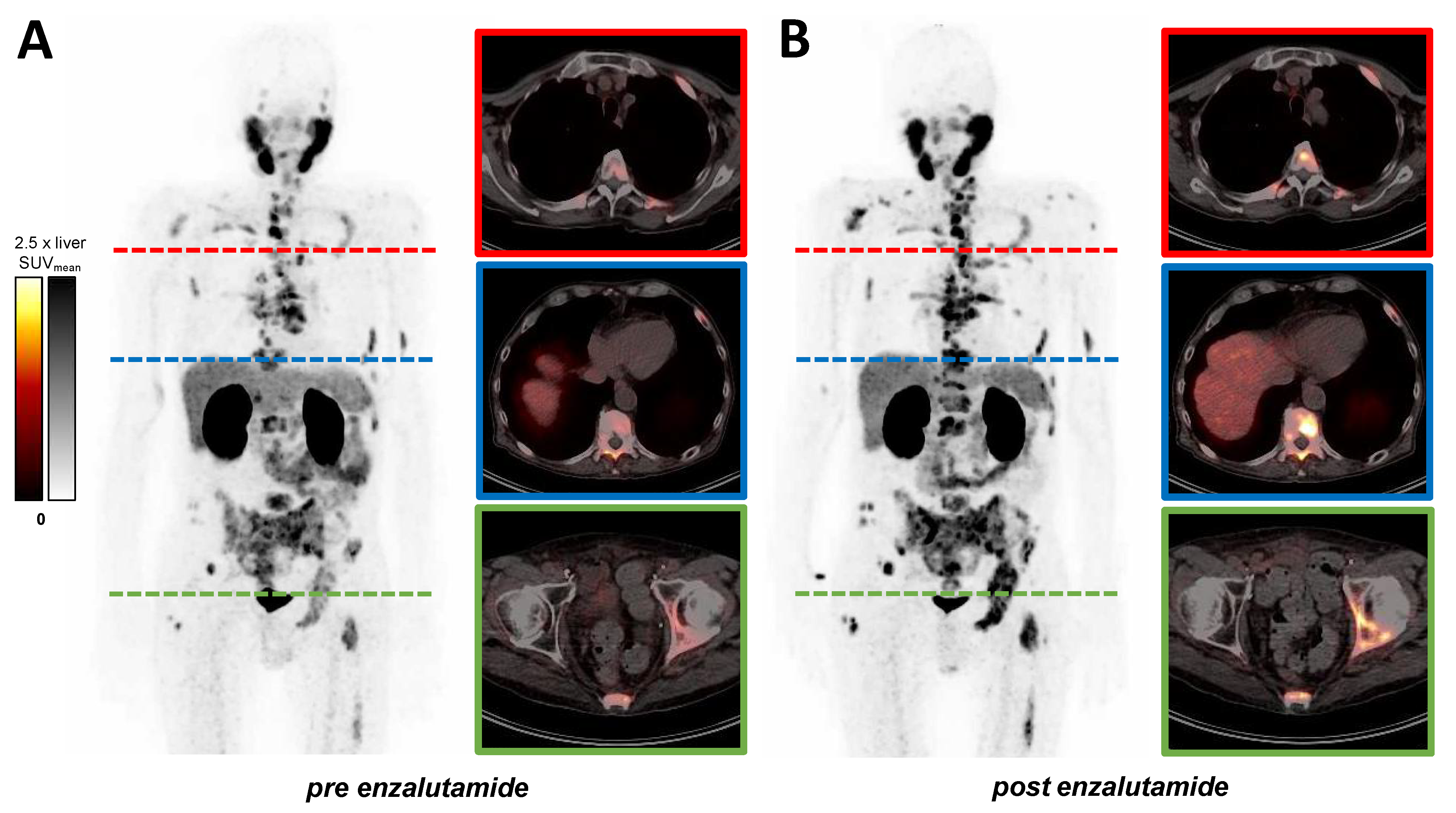 Cancers 14 01696 g004 550