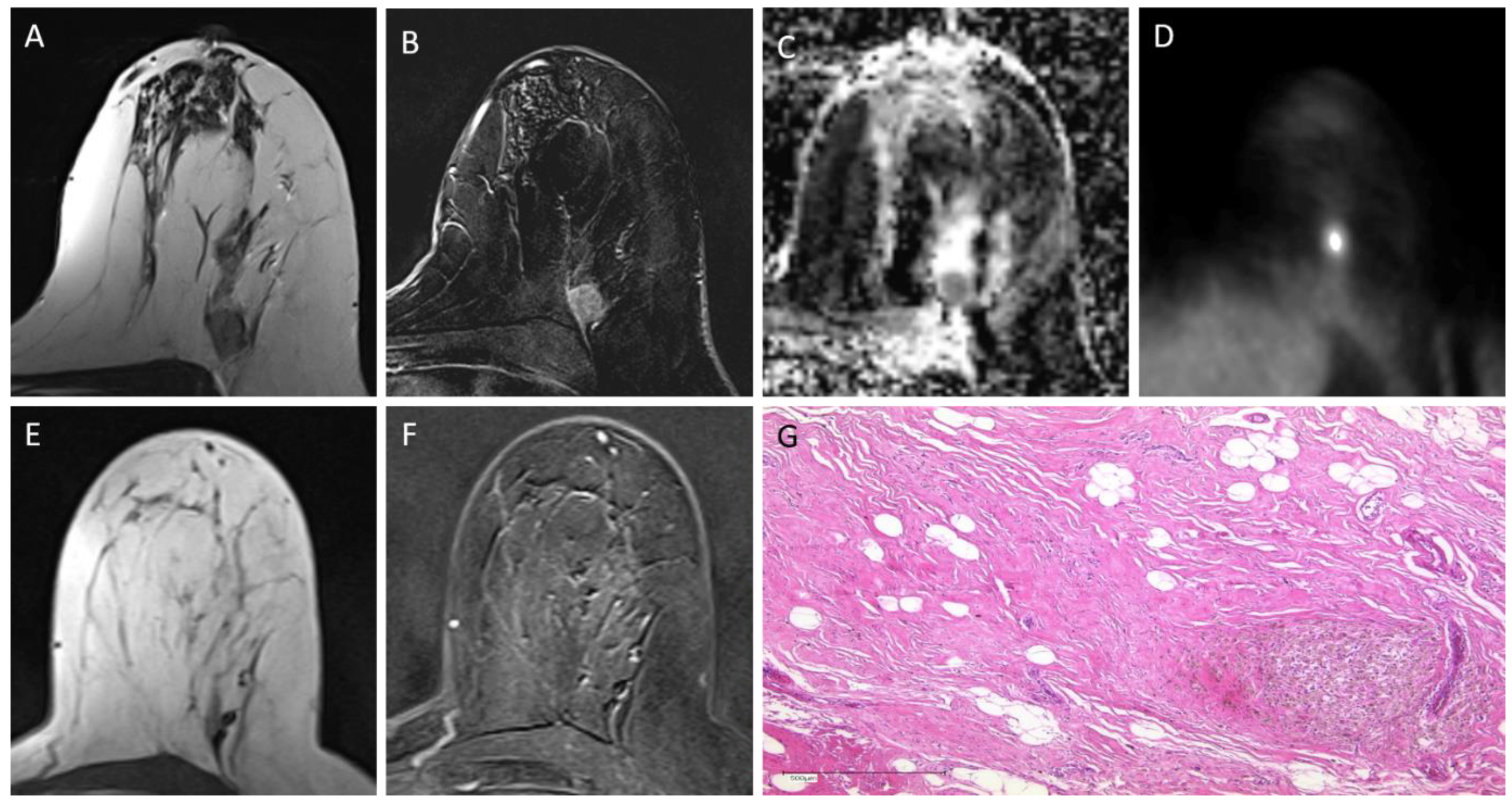 Cancers 14 01727 g001 Cancers 14 01727 g001