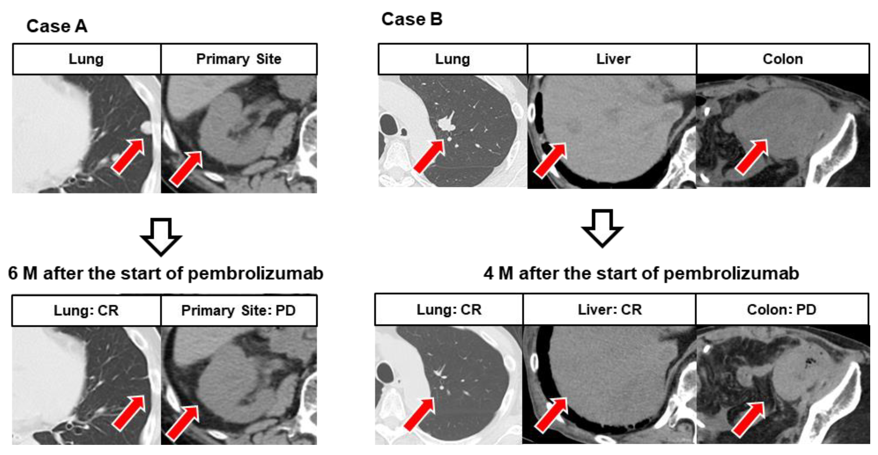 Cancers 14 01735 g004 550