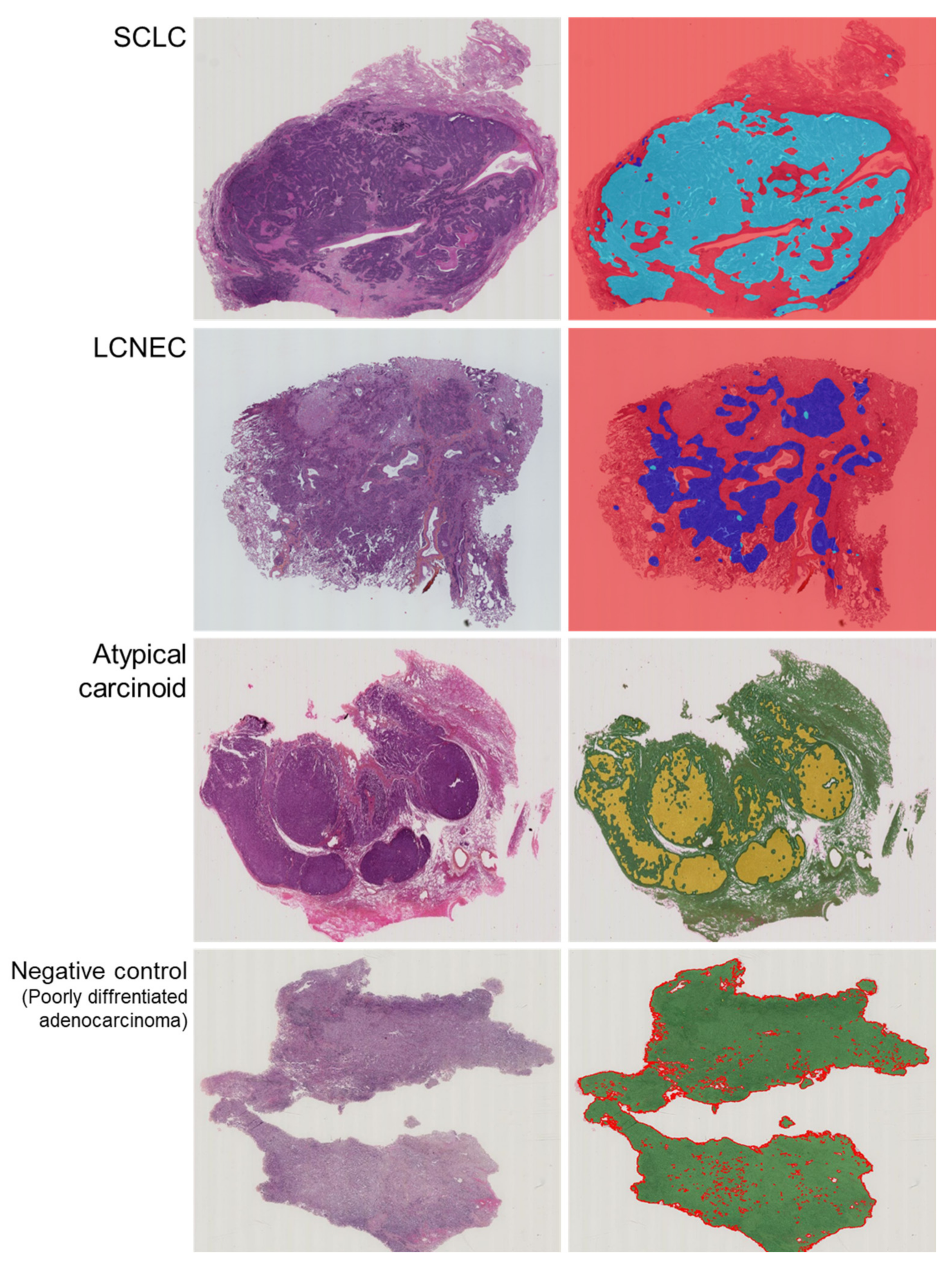 Cancers 14 01740 g001 550