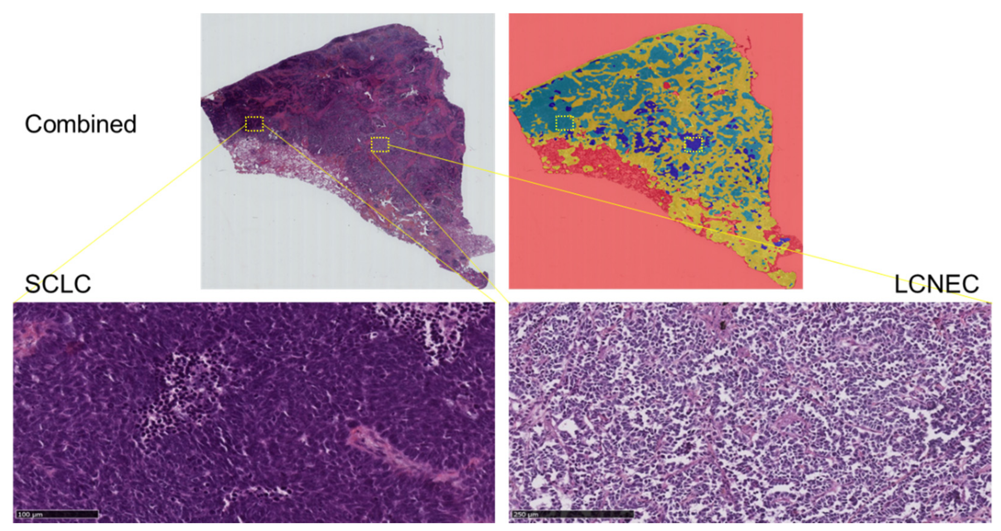 Cancers 14 01740 g002 550