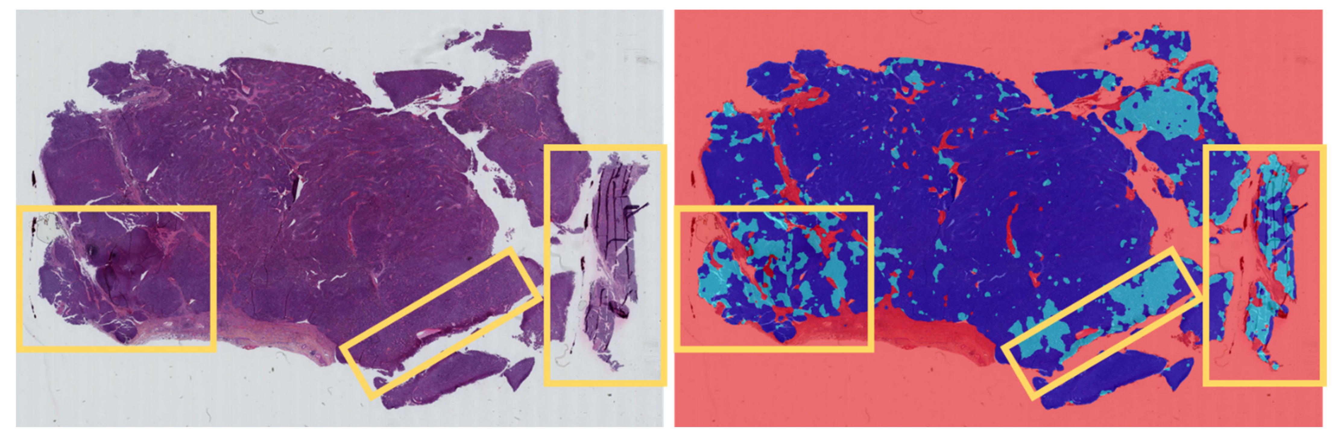 Cancers 14 01740 g004 550