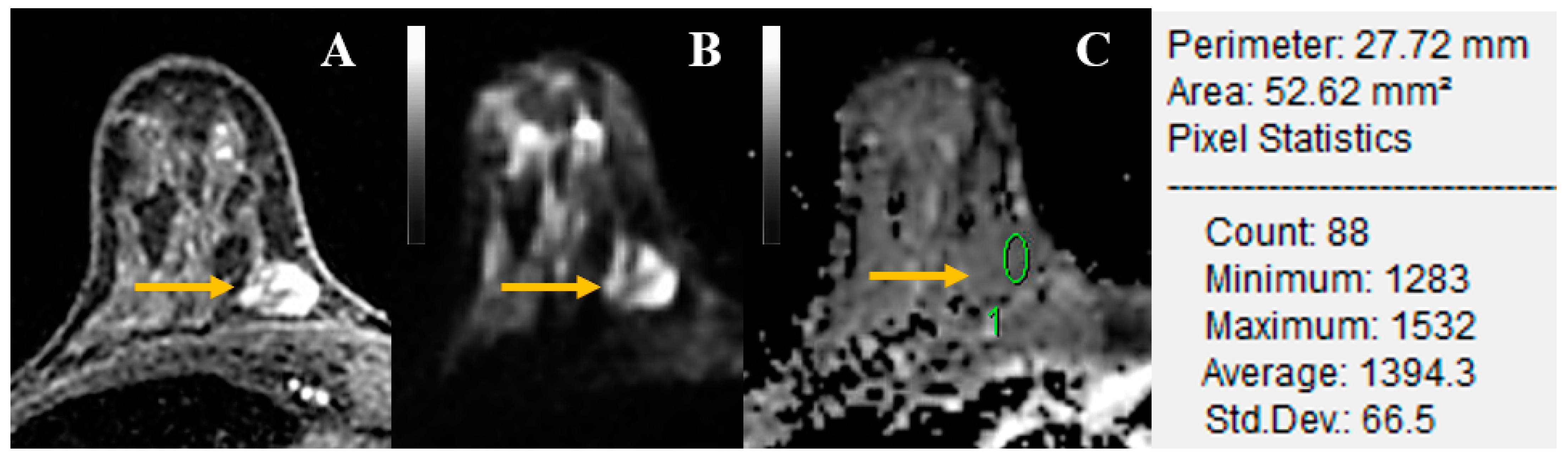 Cancers 14 01743 g002 550