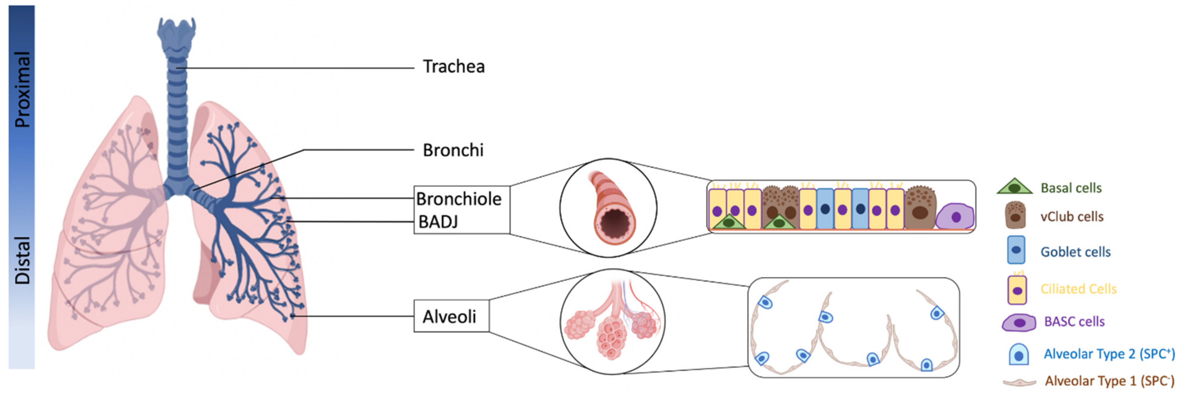 lung cancer cells diagram