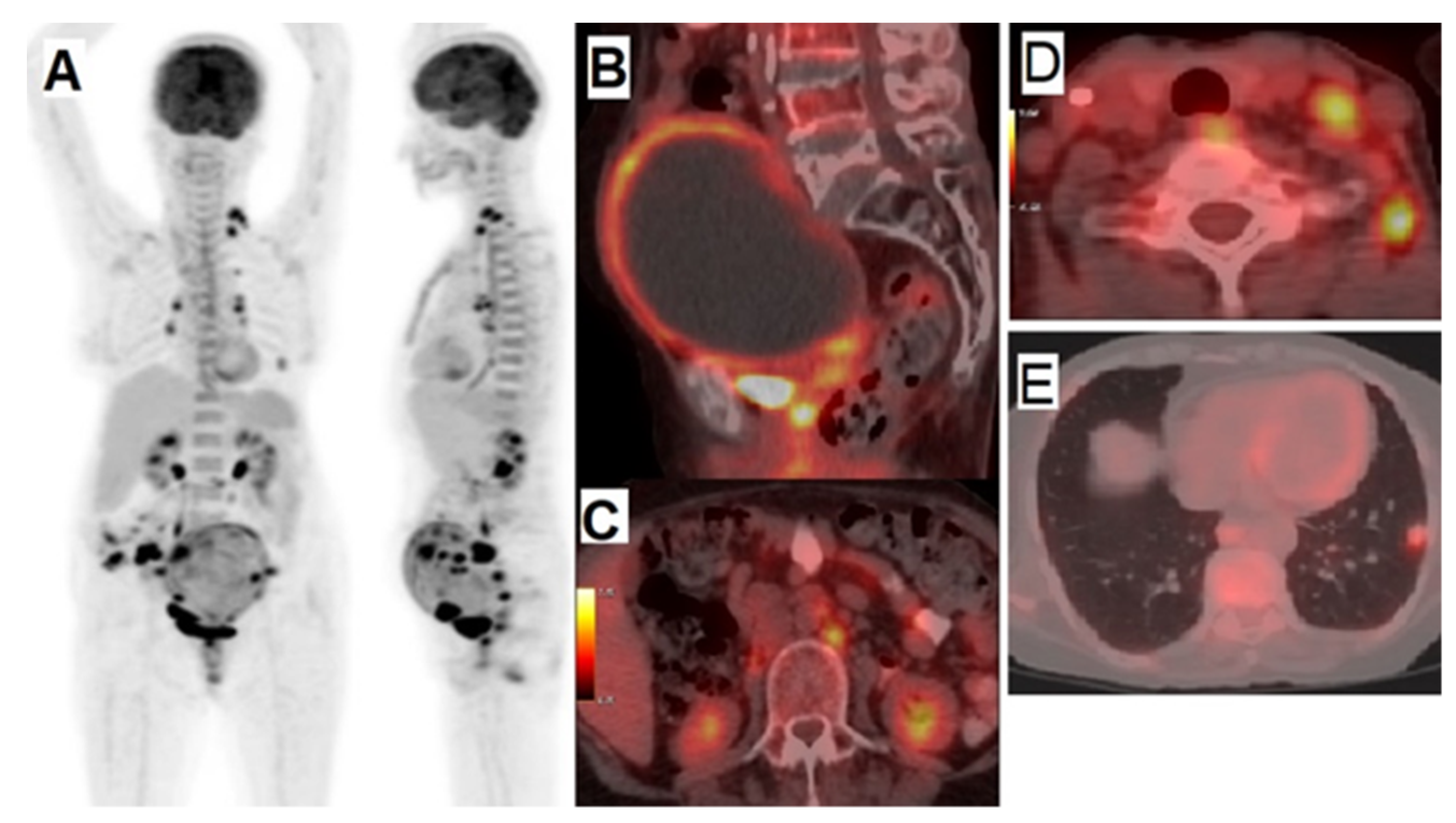 Cancers 14 01779 g002