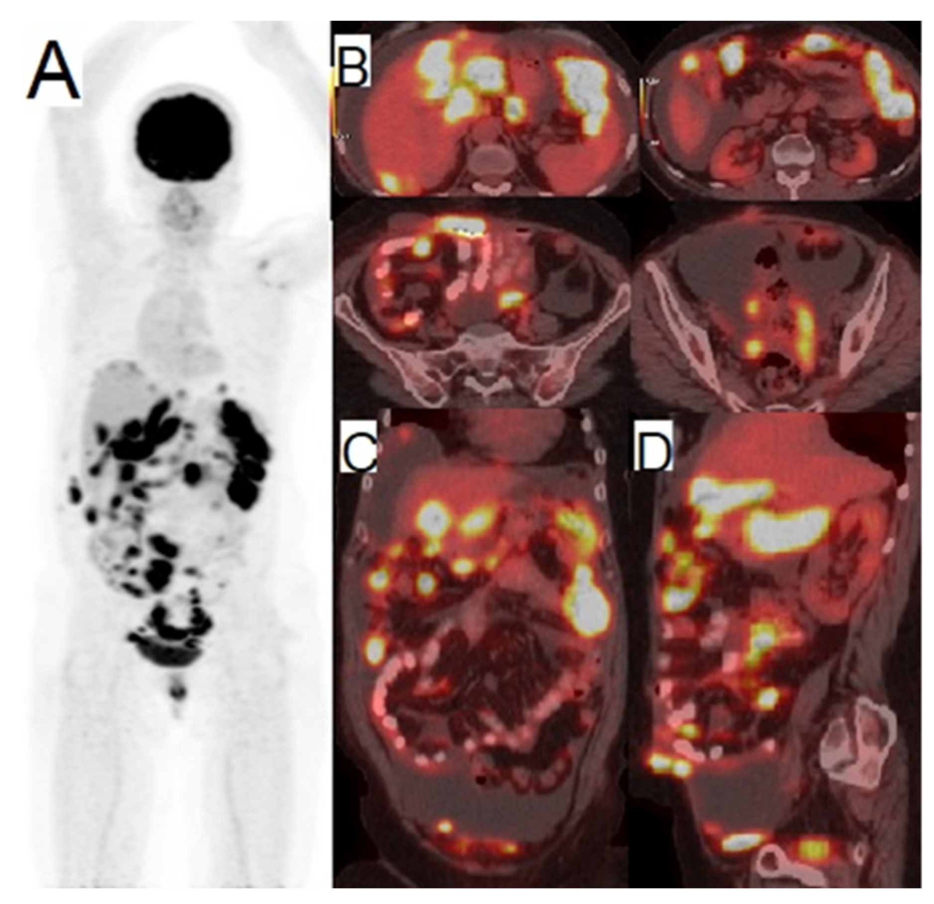 Cancers 14 01779 g004