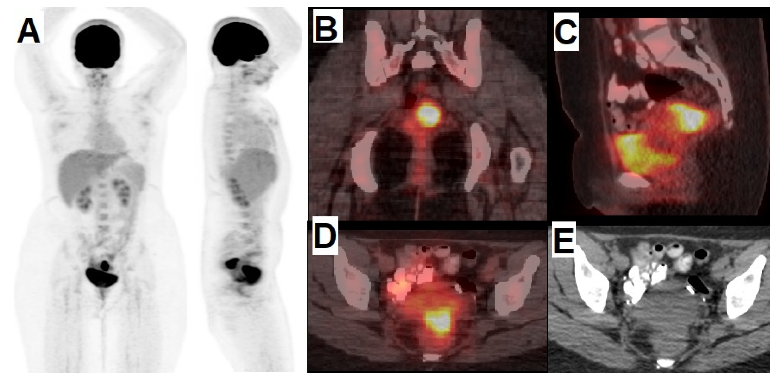 Cancers 14 01779 g005