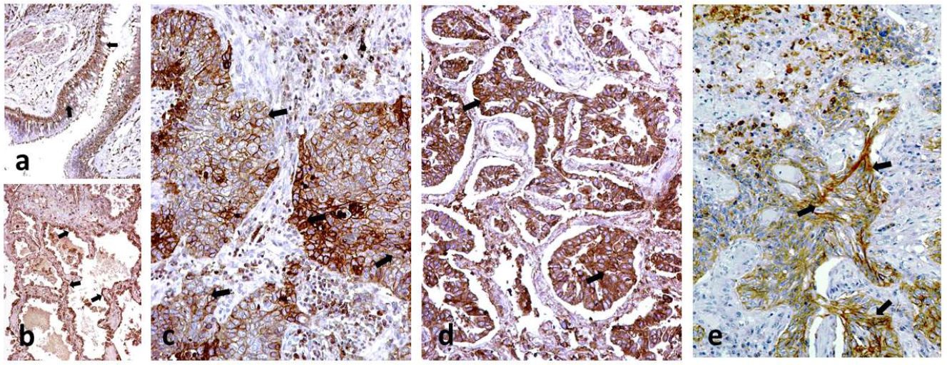 Cancers 14 01801 g001 550