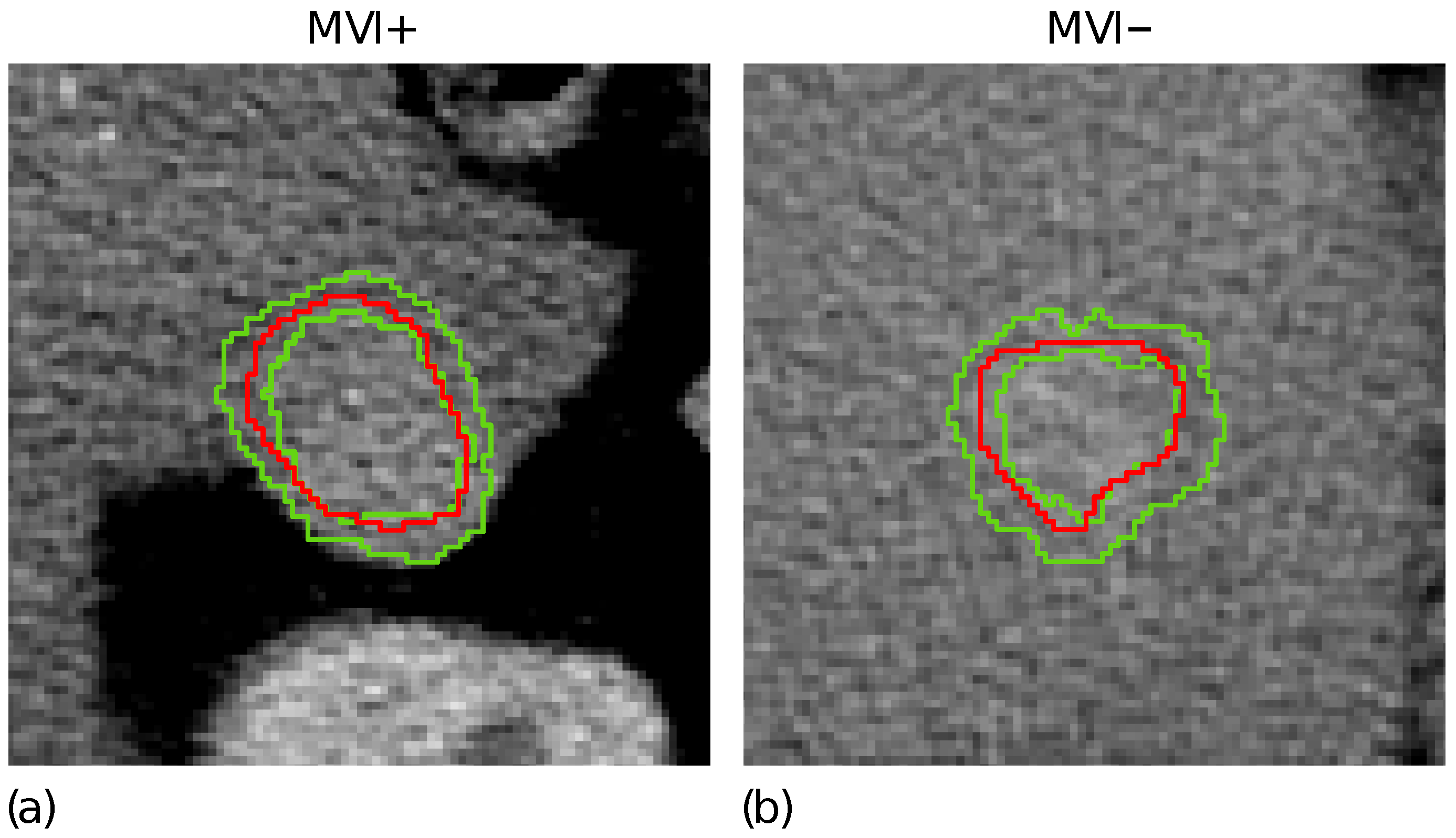 Cancers 14 01816 g002