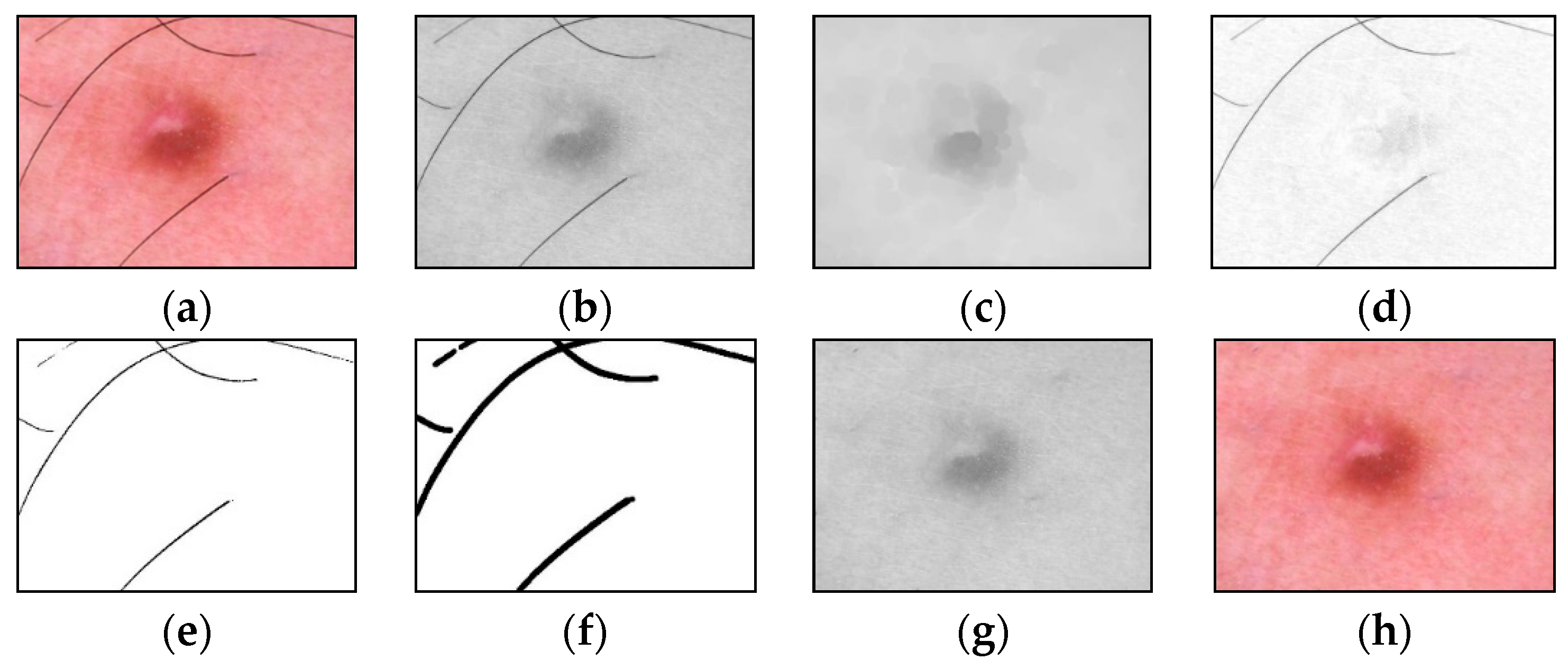 Cancers 14 01819 g004