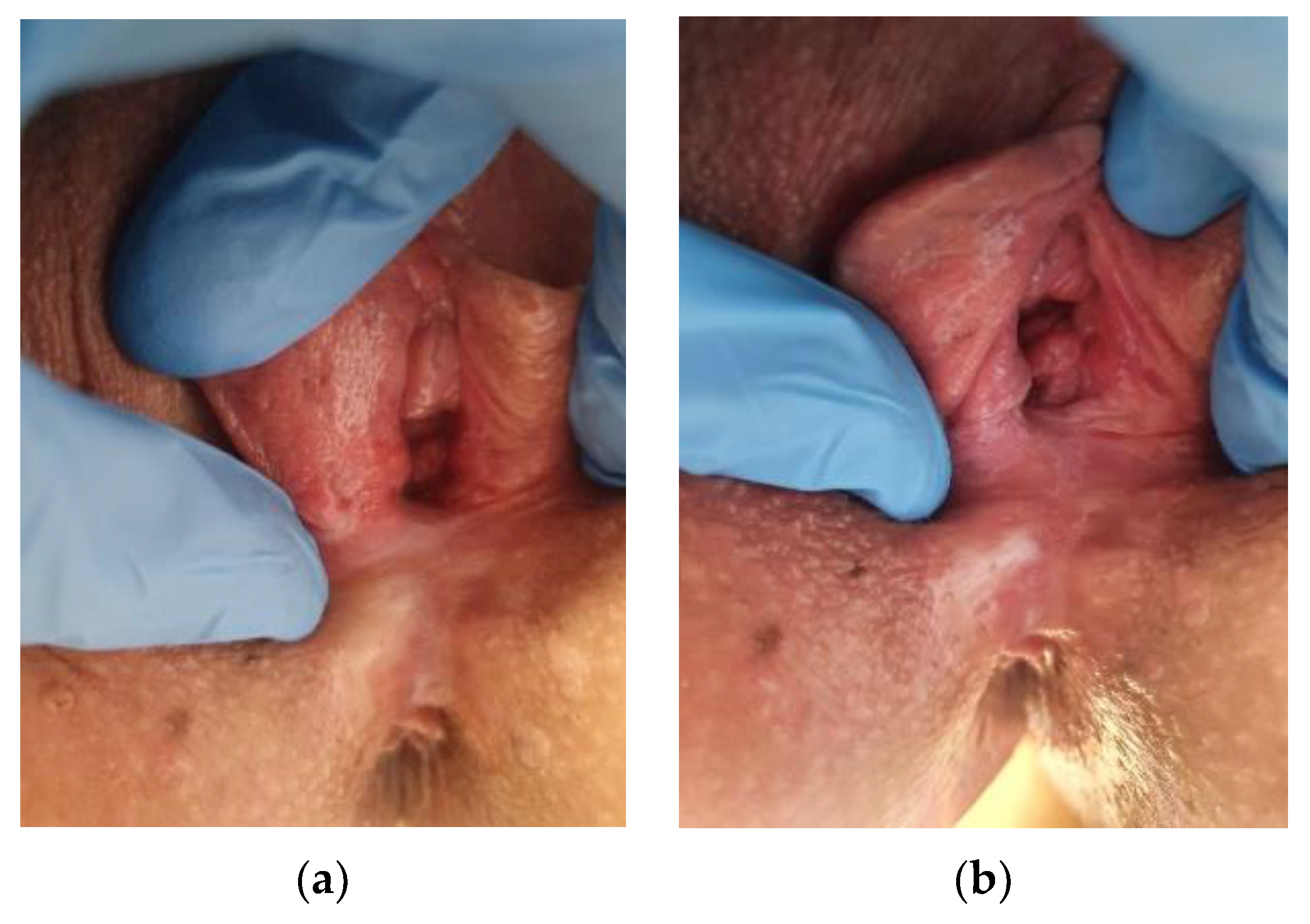 Cancers 14 01822 g003