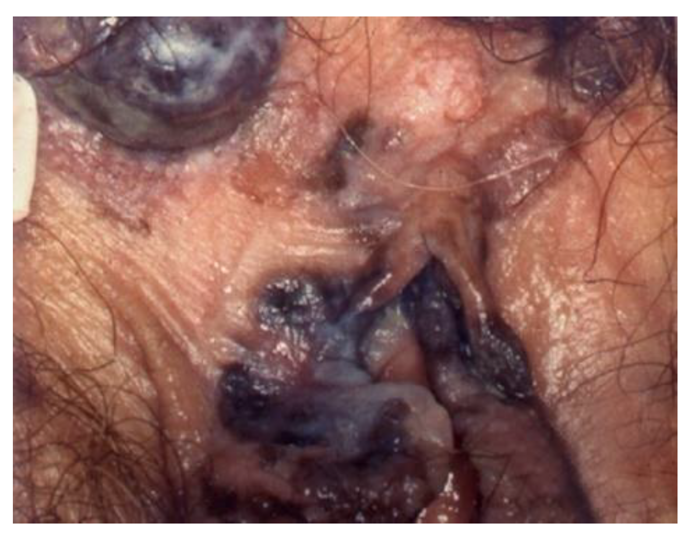 Cancers 14 01822 g014