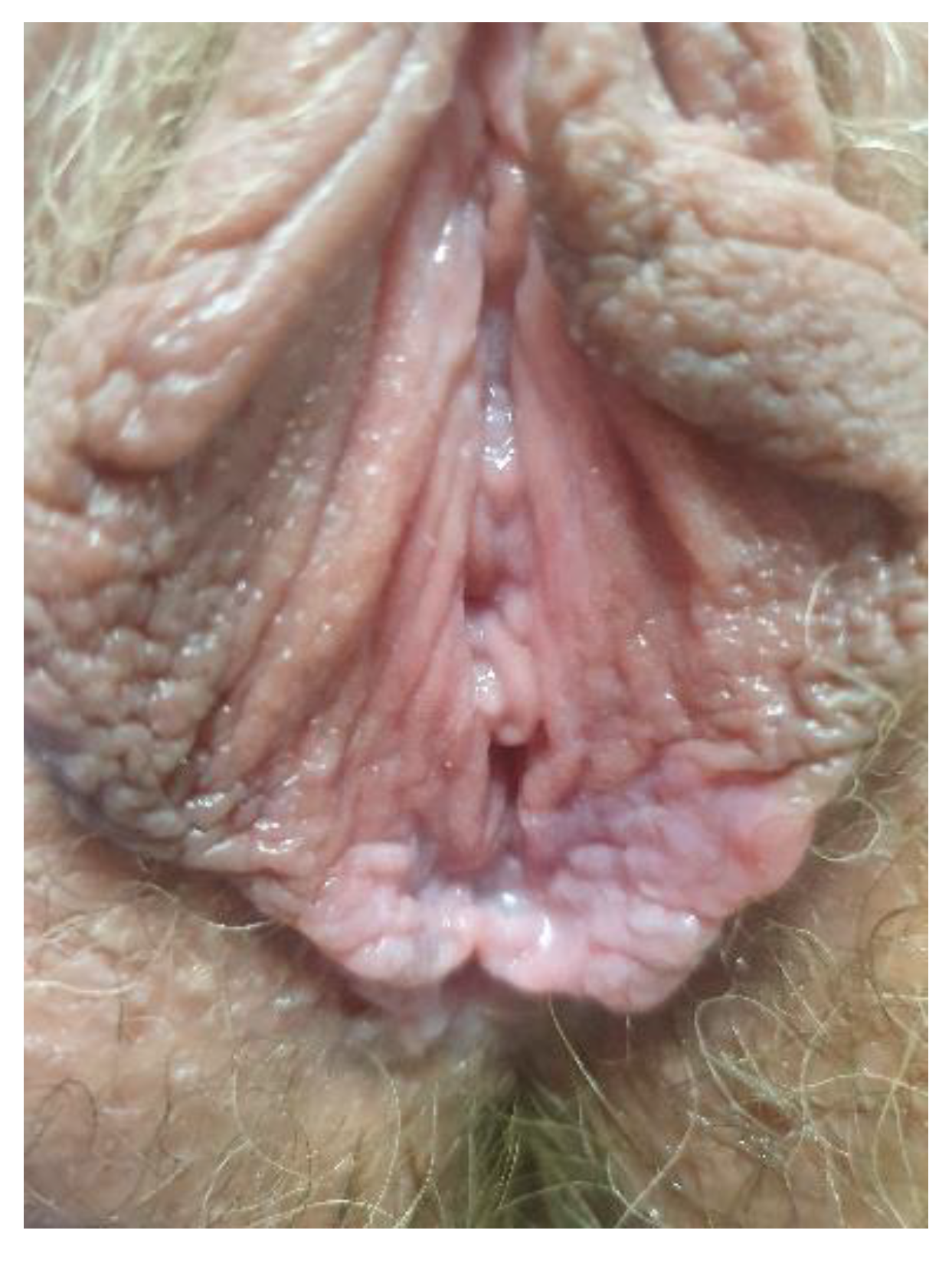 Cancers 14 01822 g021