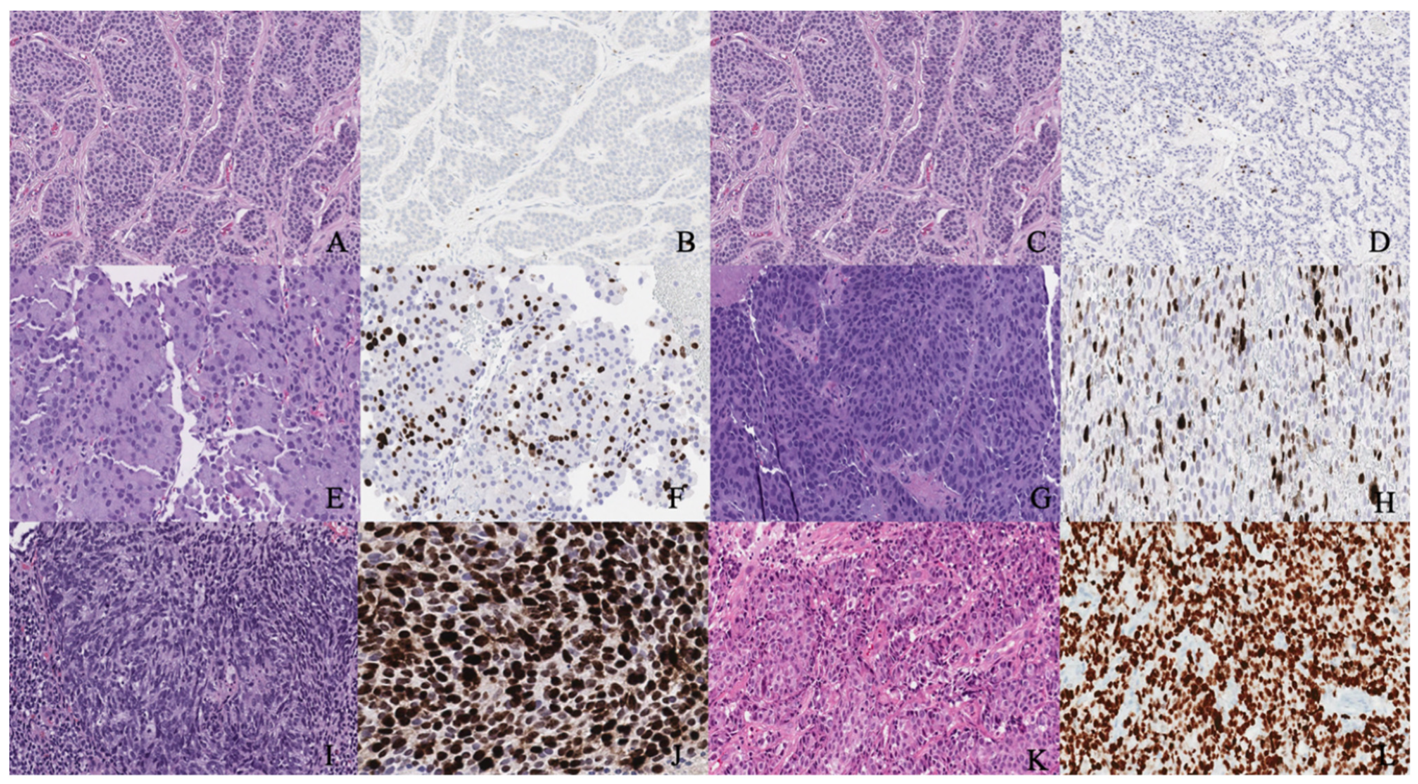 Cancers 14 01835 g002 550